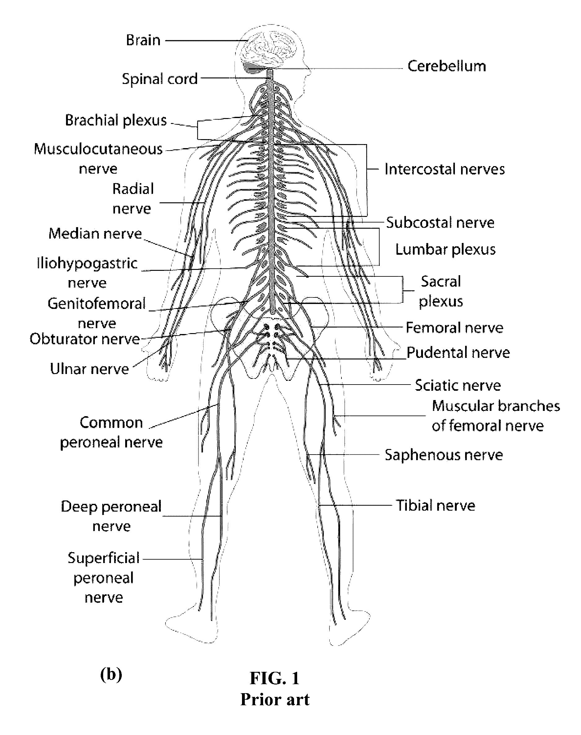 Smart joint care