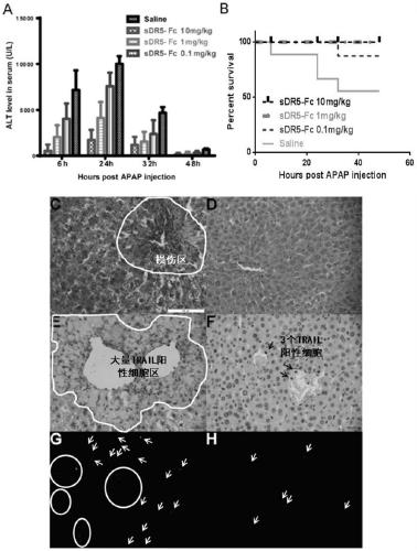 Human sDR5-Fc recombinant fusion protein and its new application