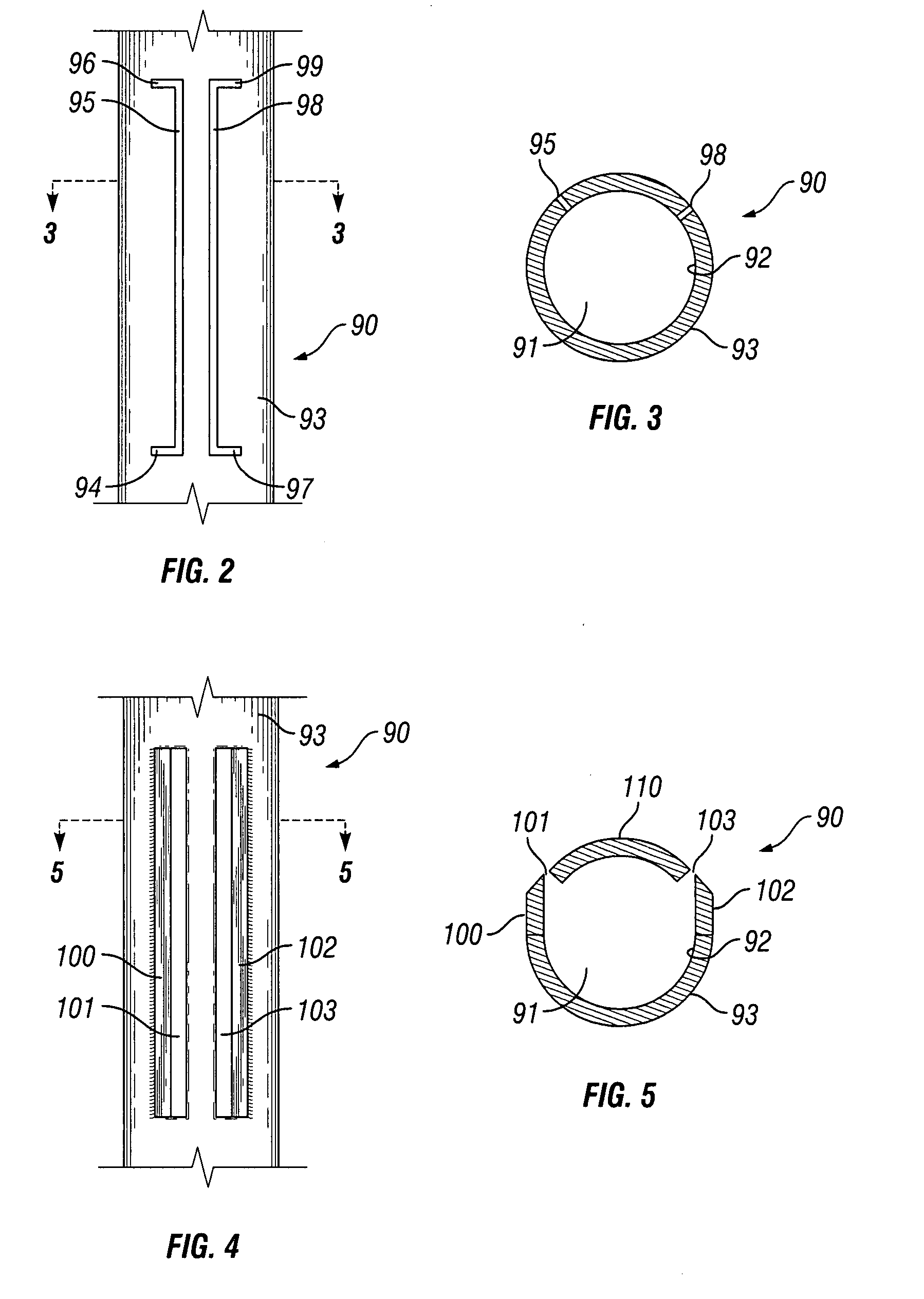 Casing profiling and recovery system