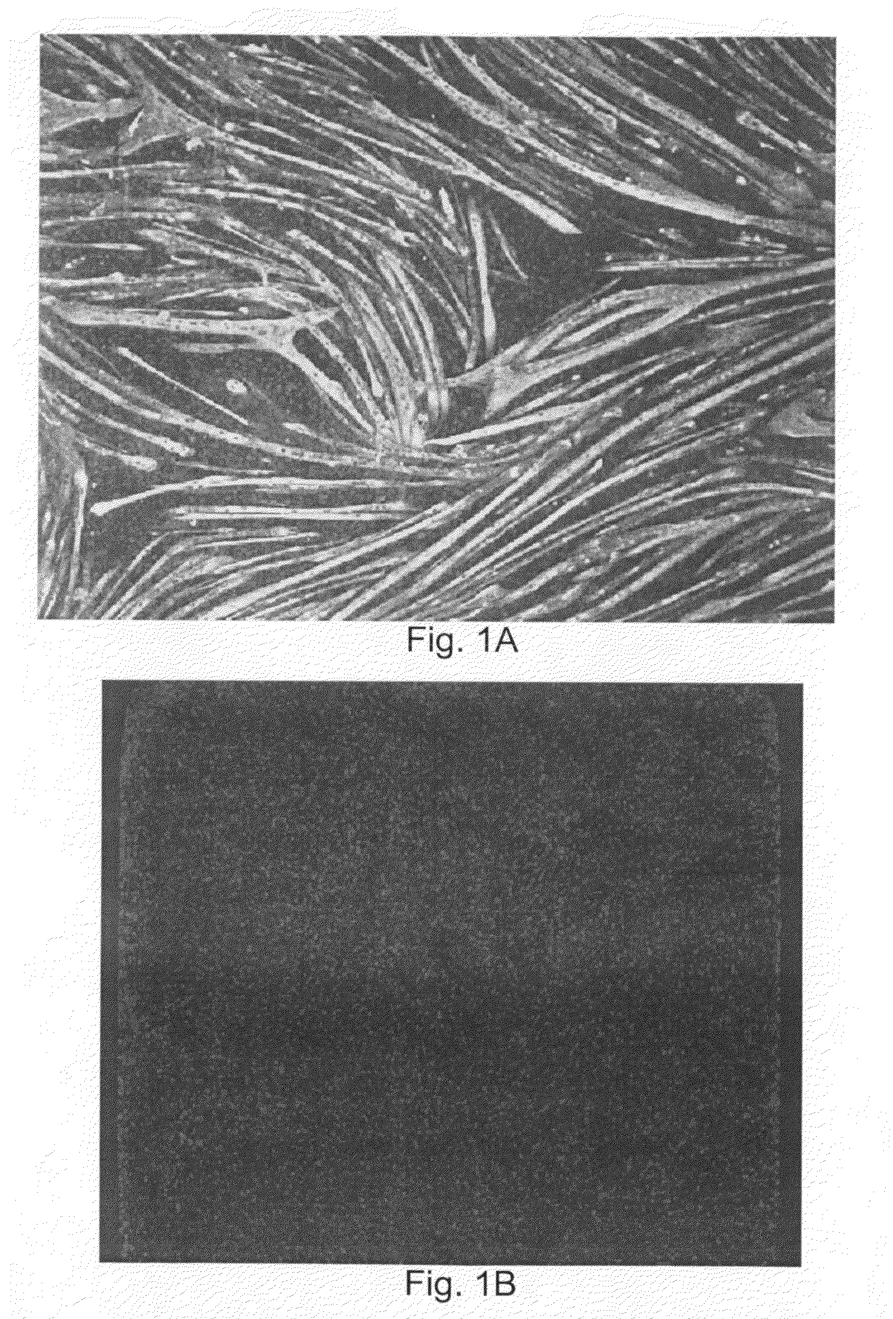 Methods and compositions for treating metabolic disorders