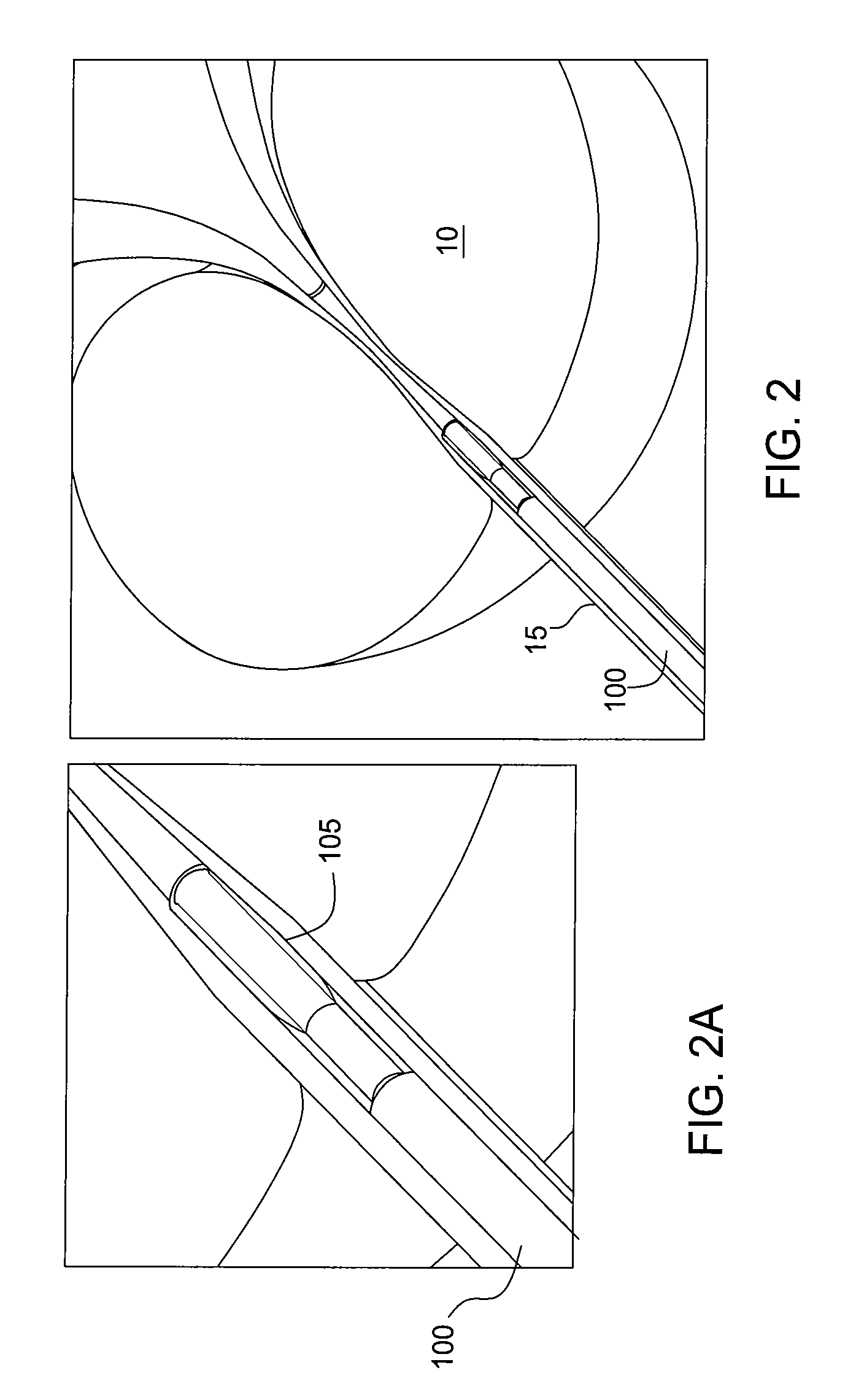 Apparatus and method for prostatic tissue removal