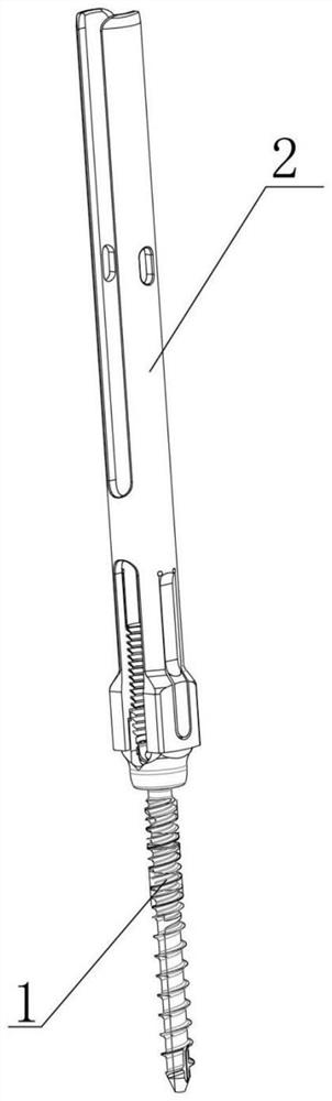 Minimally invasive surgery method for spinal internal fixation