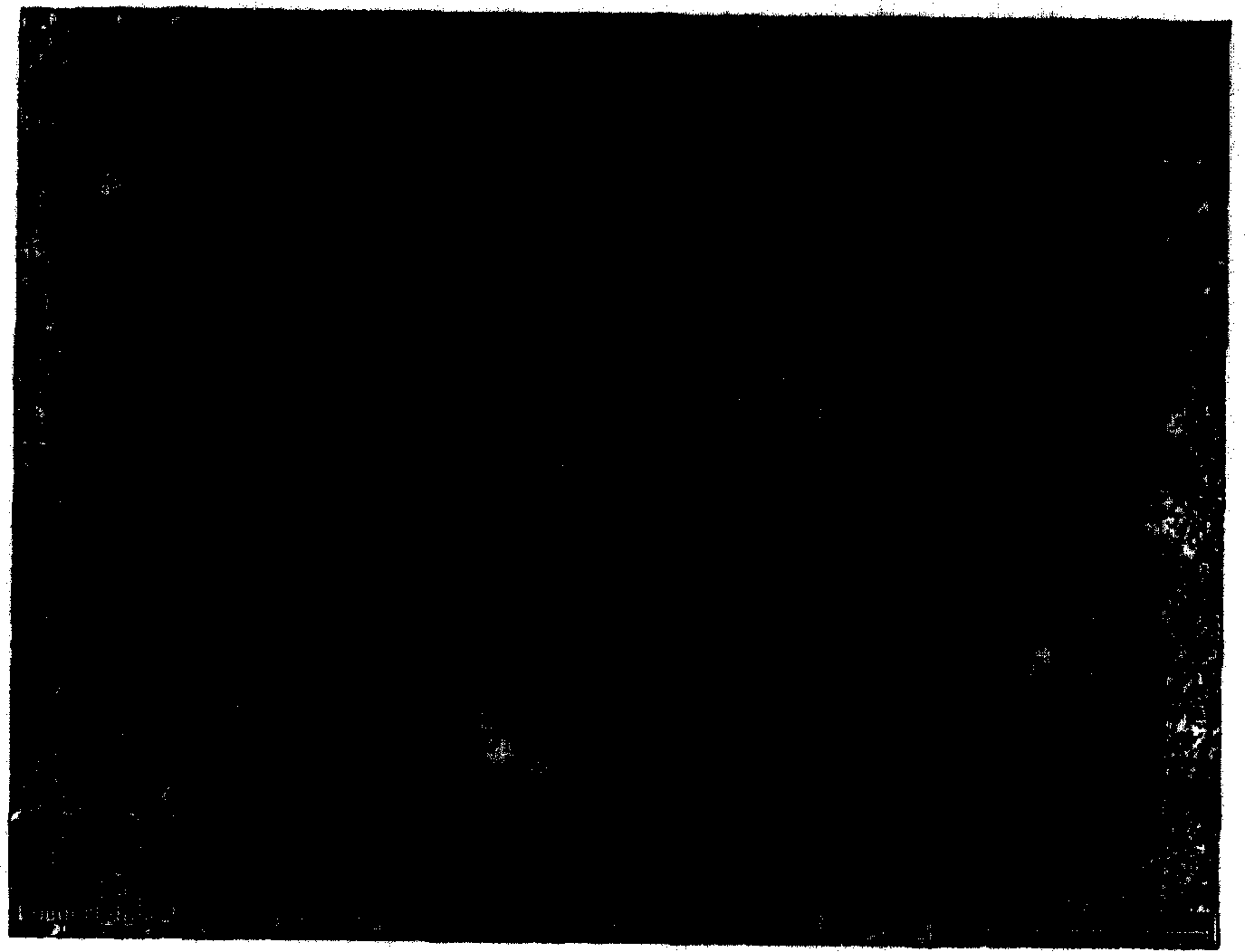 Methods for repairing and regenerating human dura mater