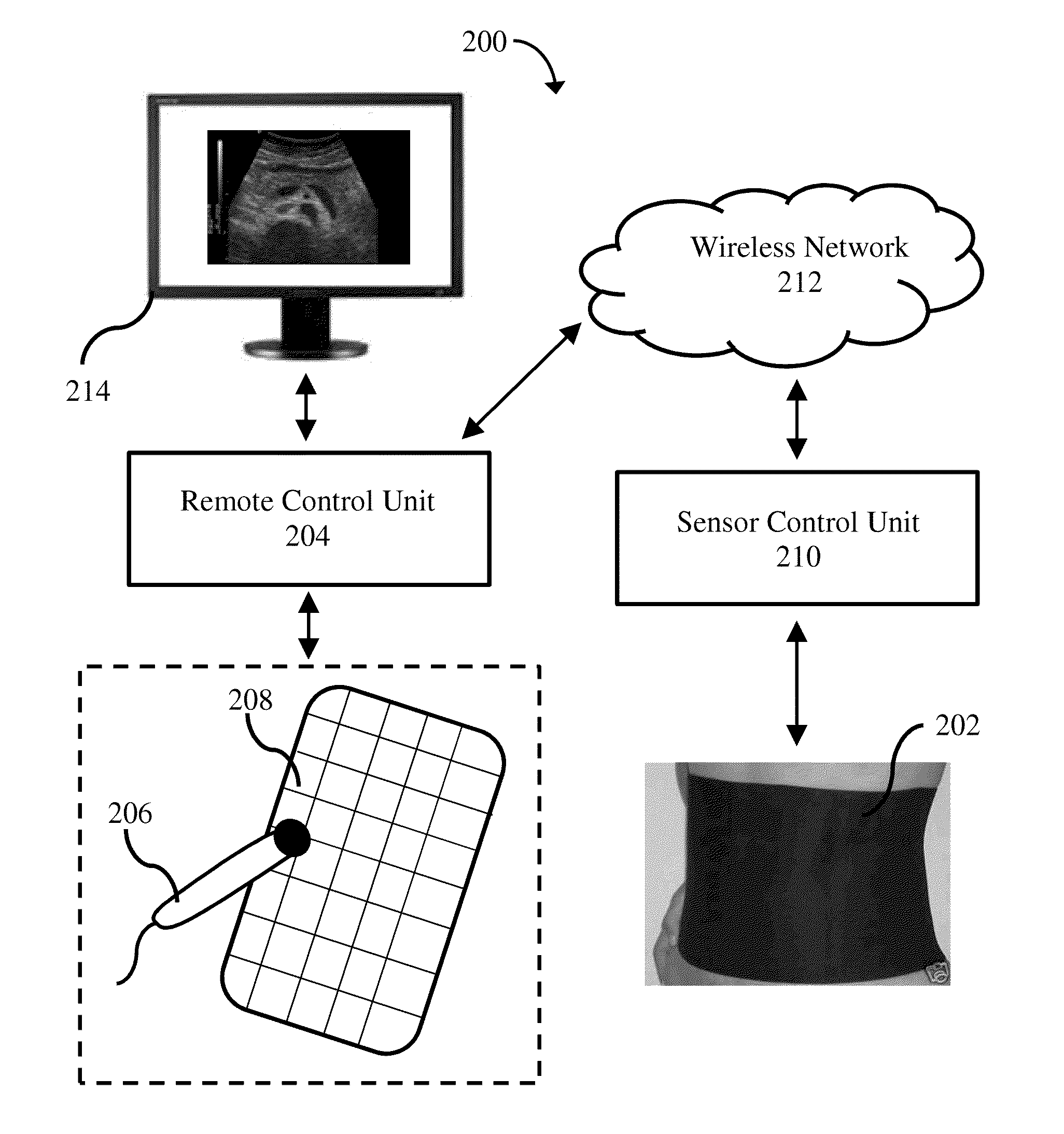 Remotely controlled ultrasound apparatus and ultrasound treatment system