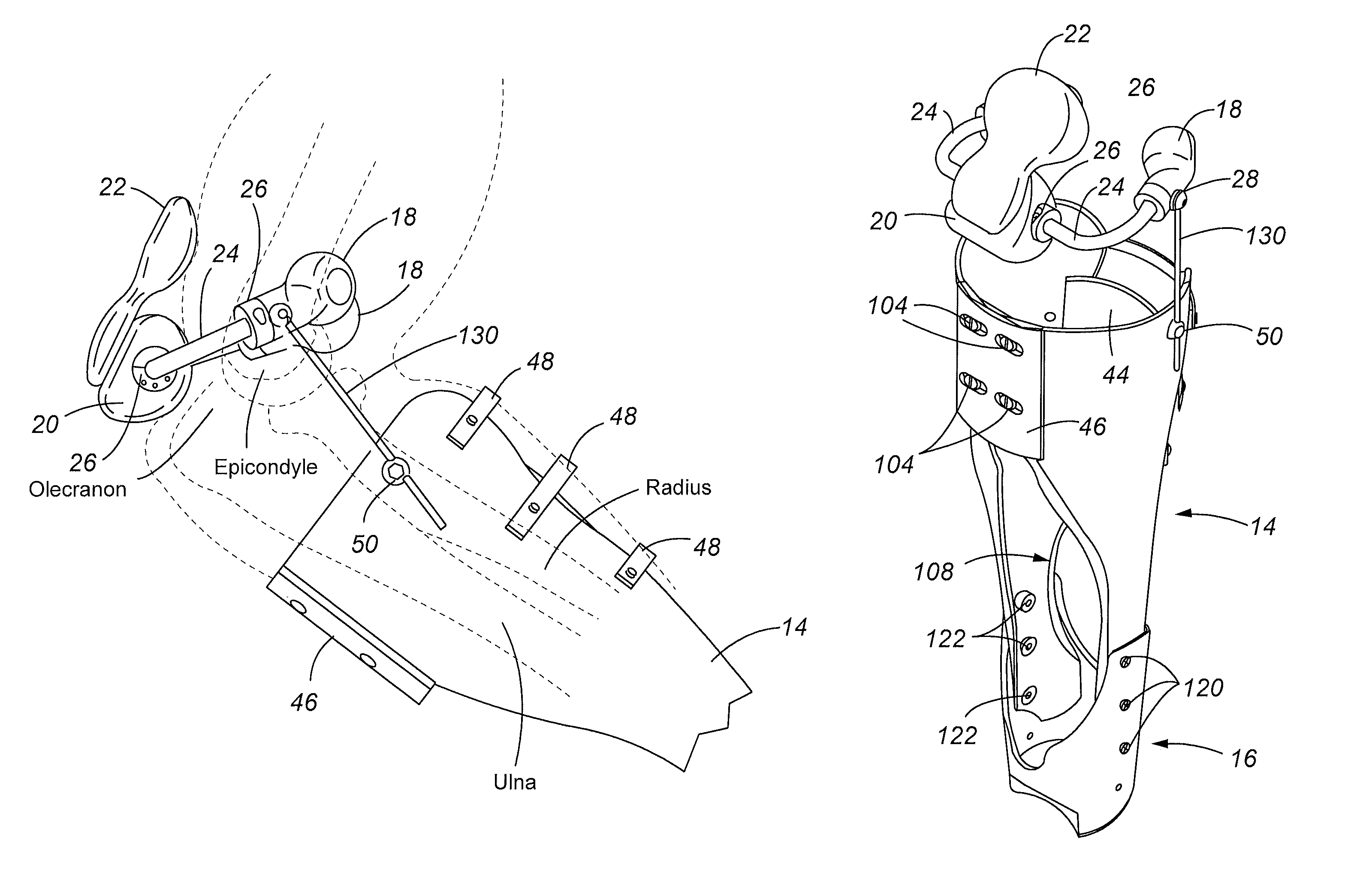 Anatomically-configured adjustable upper extremity prosthetic device