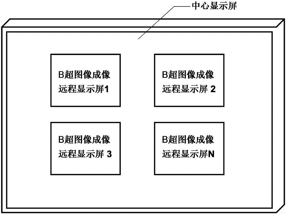 Use method for B-scan ultrasonography physical examination cluster control system based on intelligent navigation detection angle