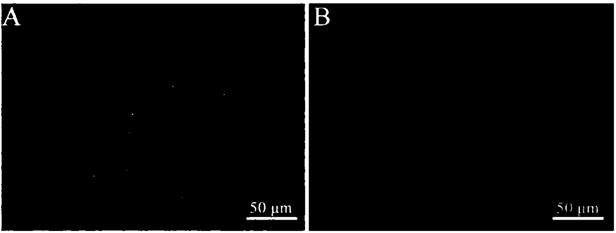 Luc-GFP marked high-transitivity human hepatoma cell line and application thereof in in situ hepatoma model