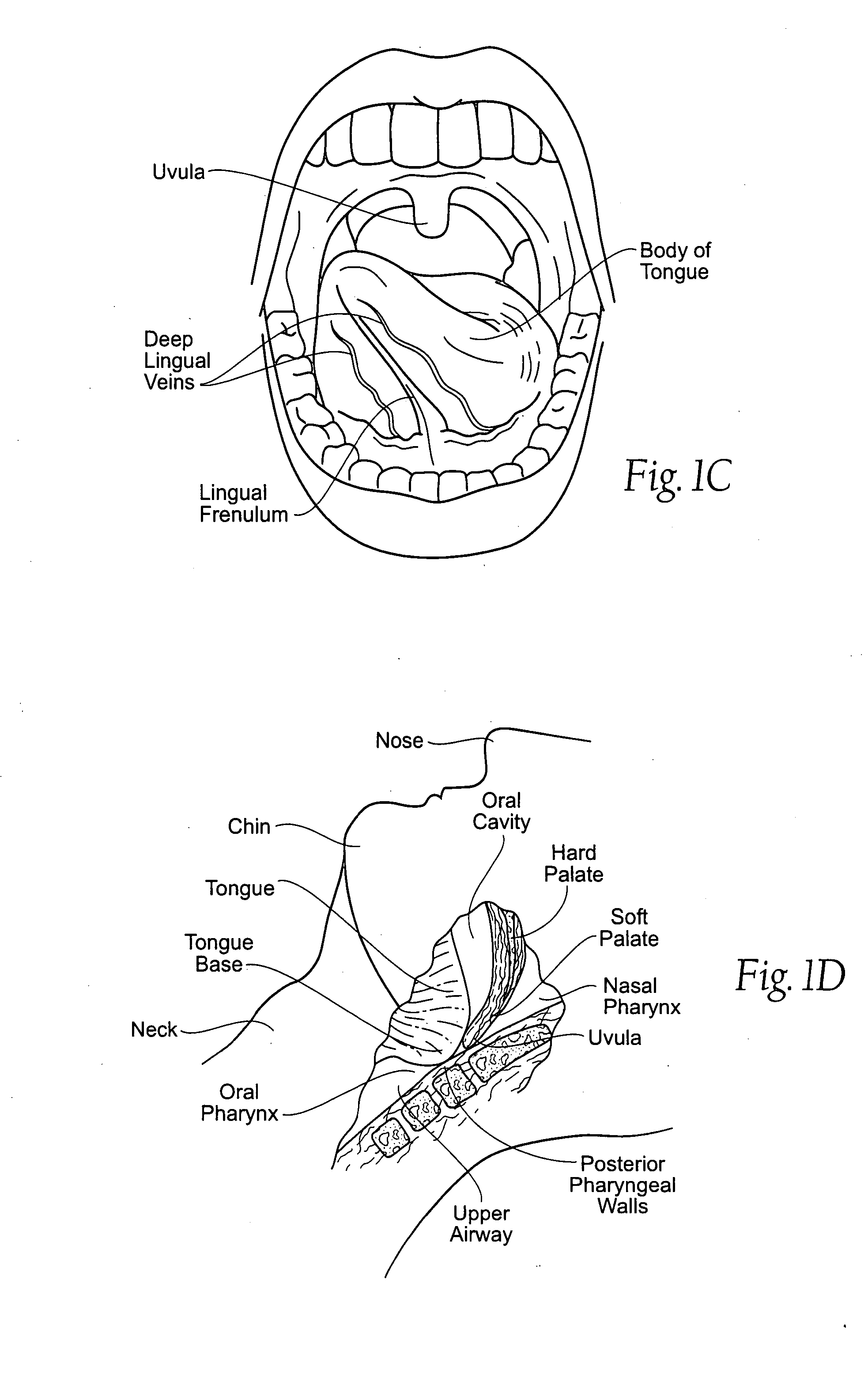 Implantable devices, systems, and methods for maintaining desired orientations in targeted tissue regions