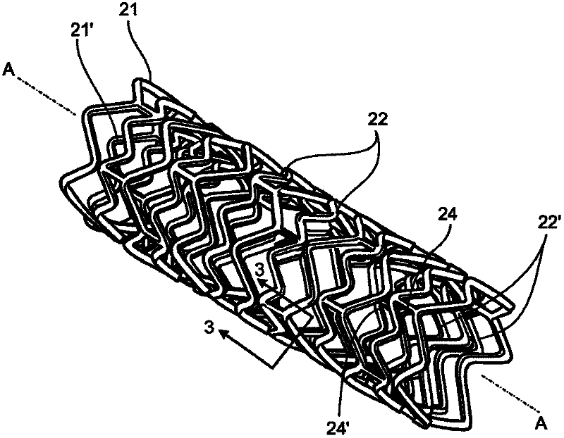 Bioerodible endoprosthesis