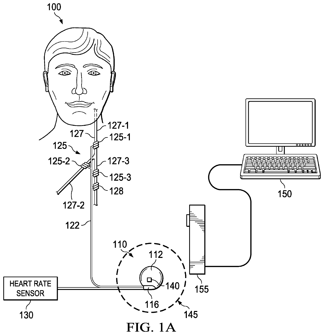 Contingent cardio-protection for epilepsy patients