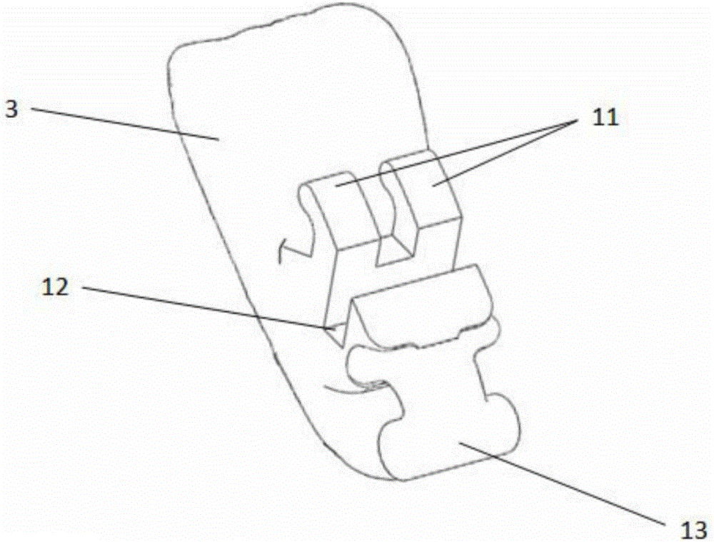 Individual lingual bracket appliance and manufacture method thereof