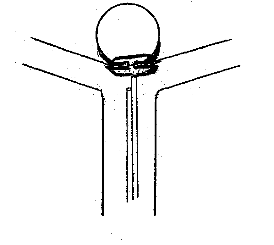 Aneurysm sealing device