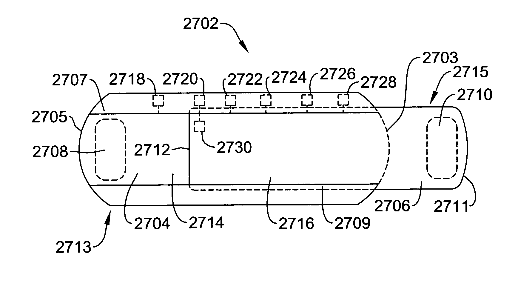 Subcutaneous implantable cardioverter-defibrillator employing a telescoping lead