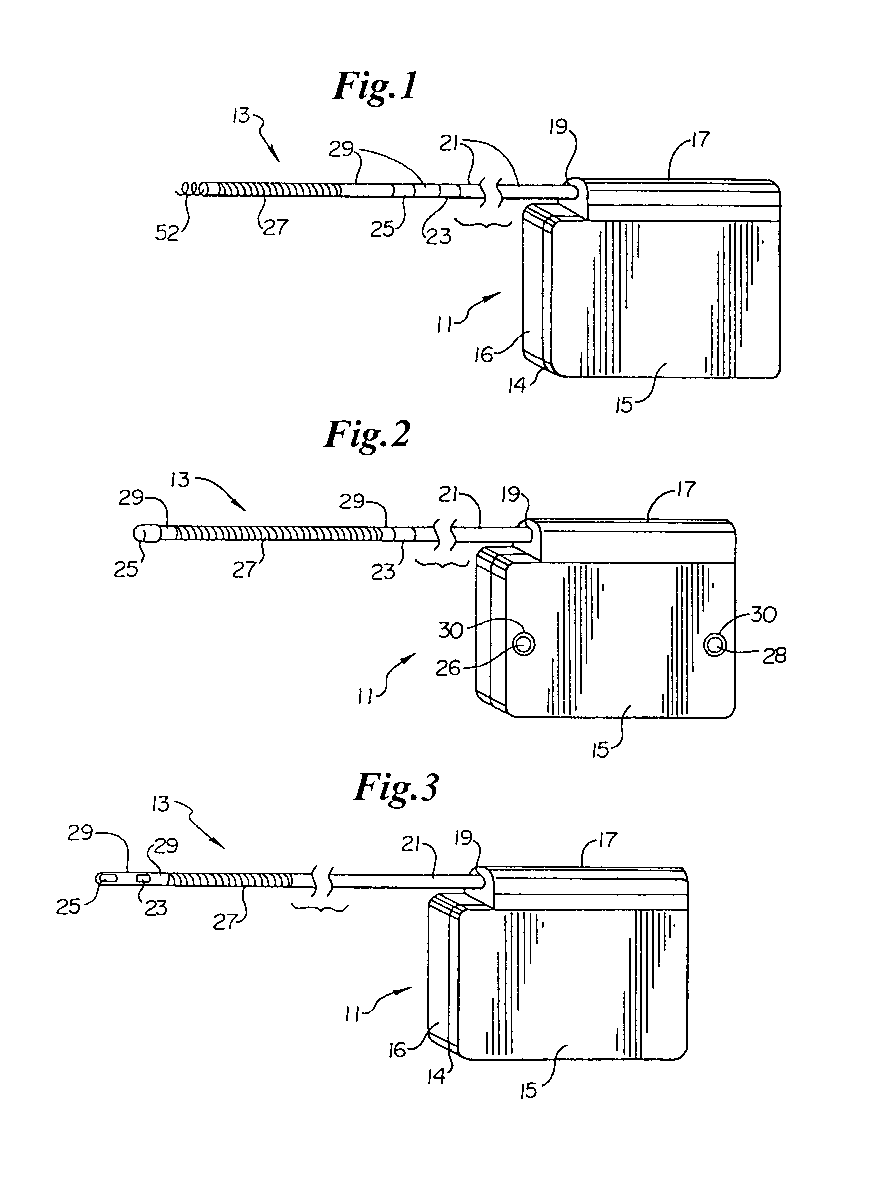 Subcutaneous implantable cardioverter-defibrillator employing a telescoping lead