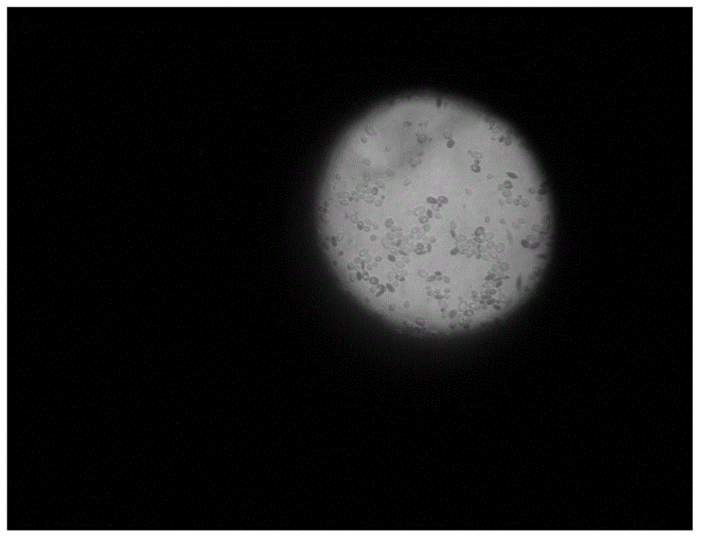 Loquat Saccharomyces cerevisiae and its application