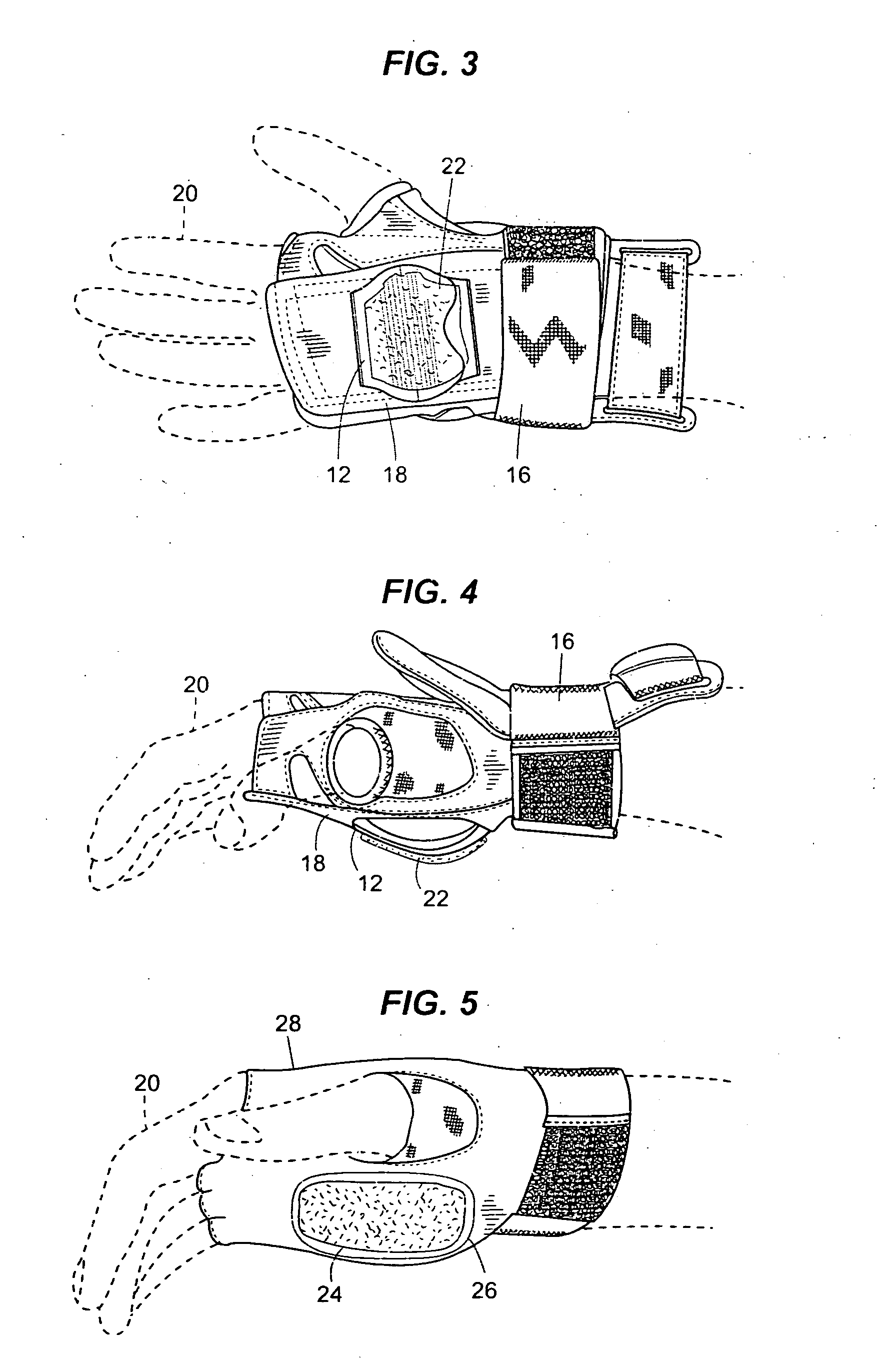 High-friction glove/wrist guards for ice skating