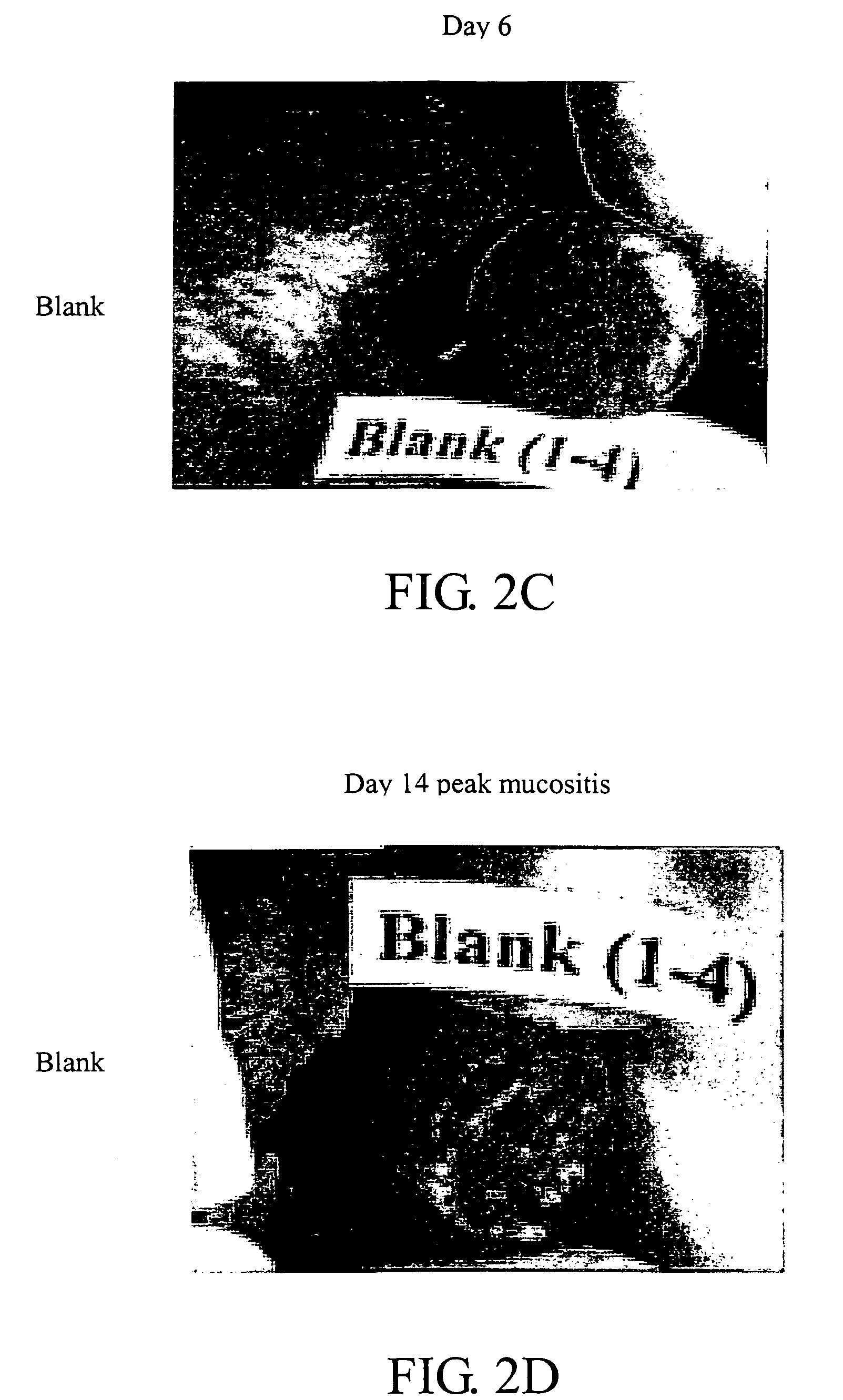 Method and compositions for treatment of epithelial damage