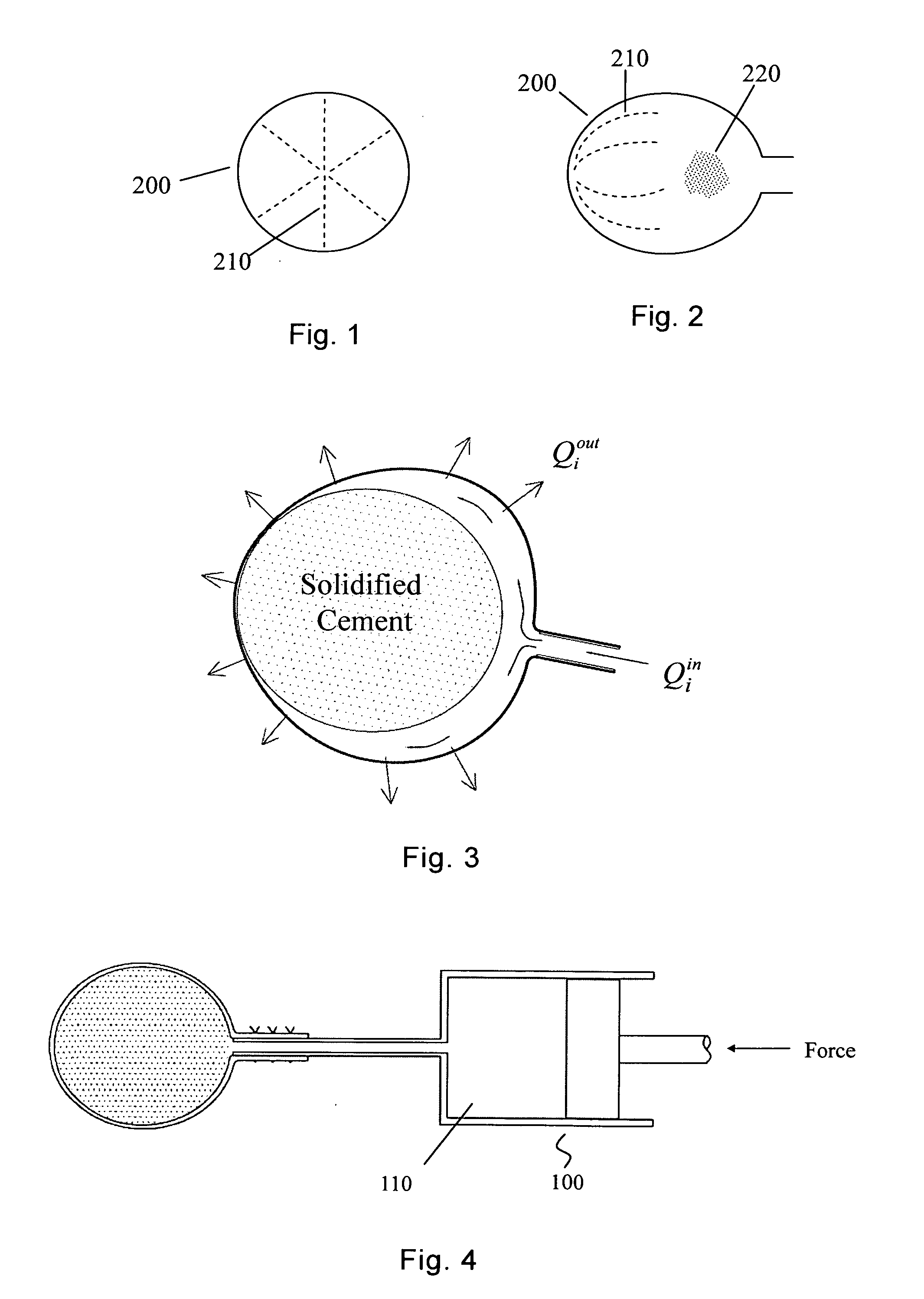 Perforated balloon and method for forming a hardened orthopaedic paste in a bone using same