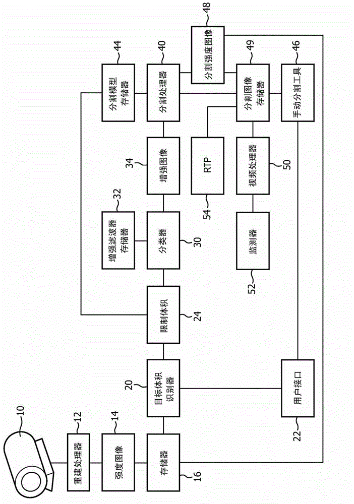 Organ-specific enhancement filter for robust segmentation of medical images