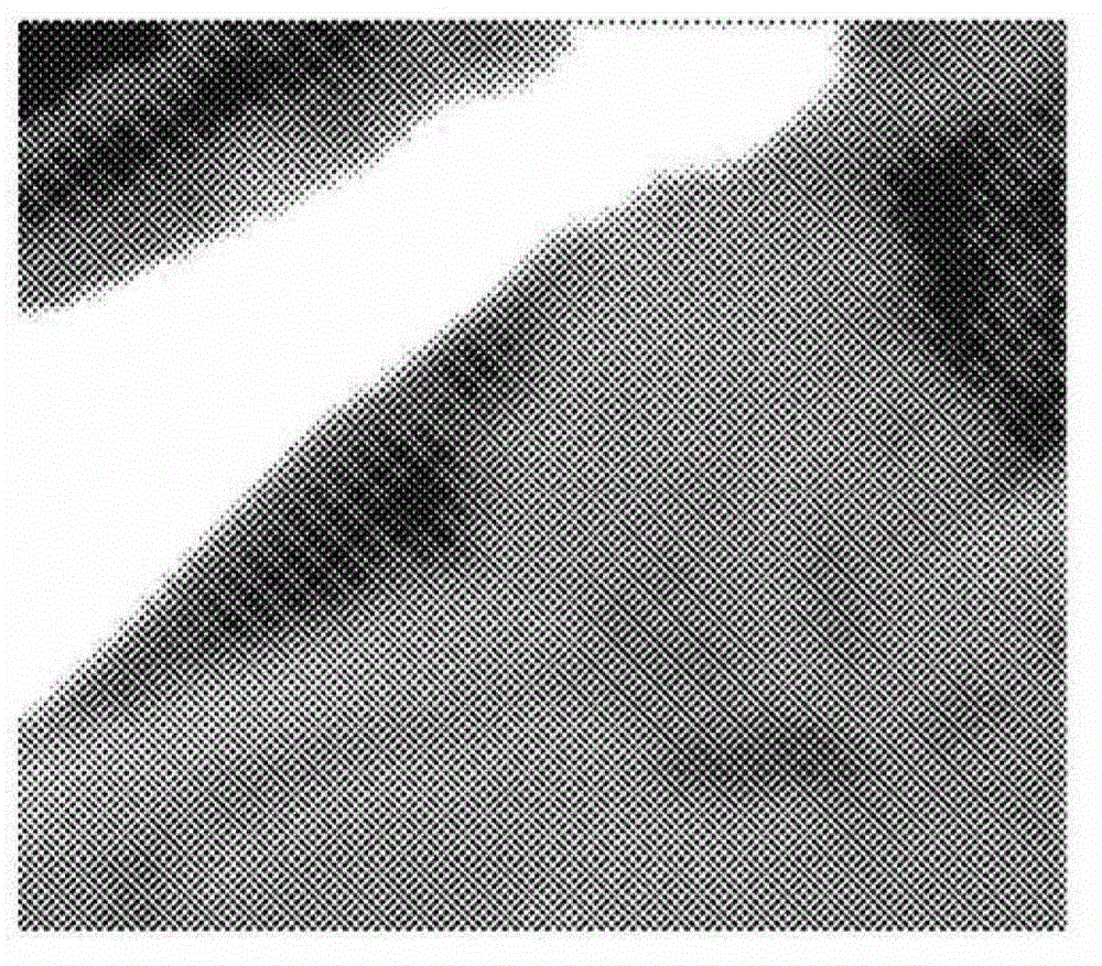 Organ-specific enhancement filter for robust segmentation of medical images