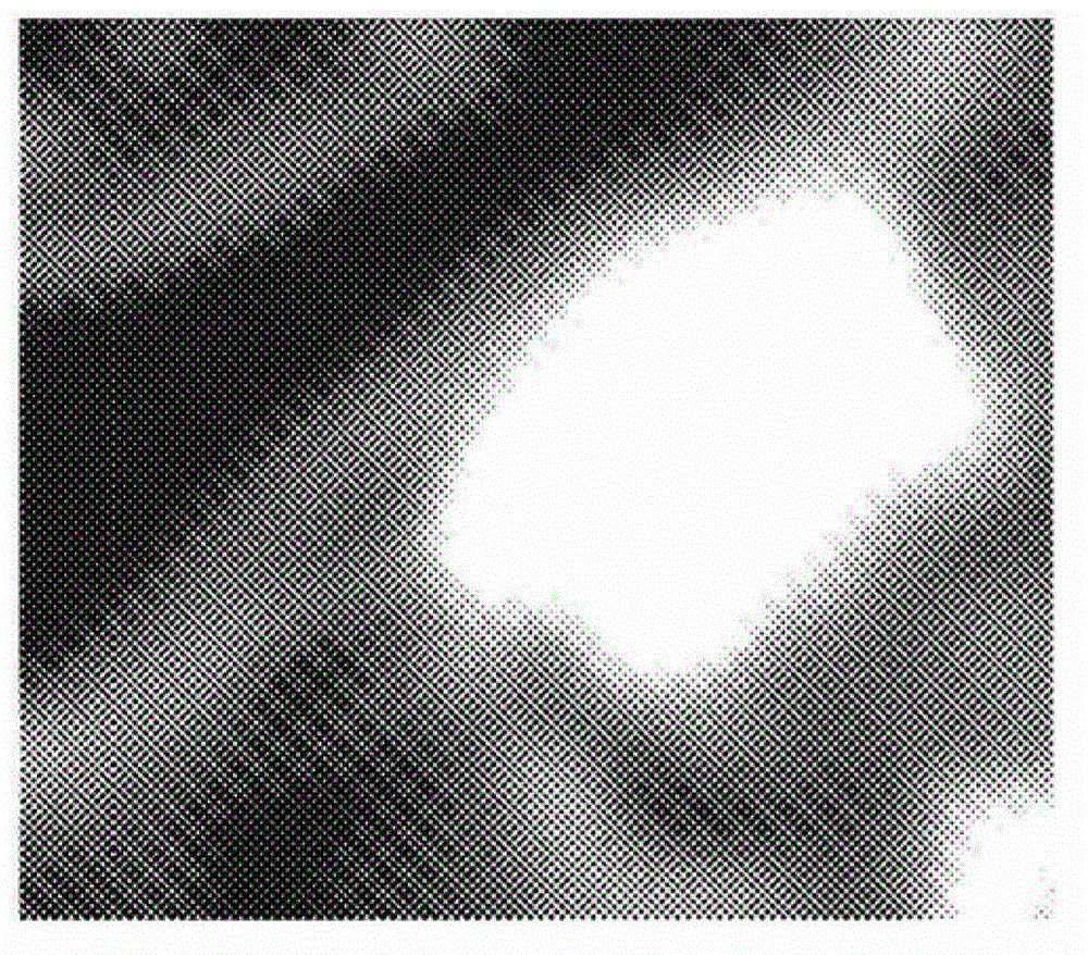 Organ-specific enhancement filter for robust segmentation of medical images