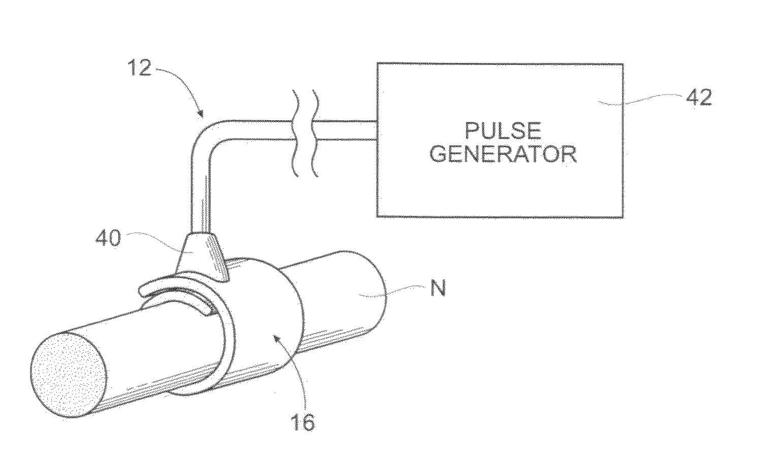 Devices, Systems, and methods employing a molded nerve cuff electrode