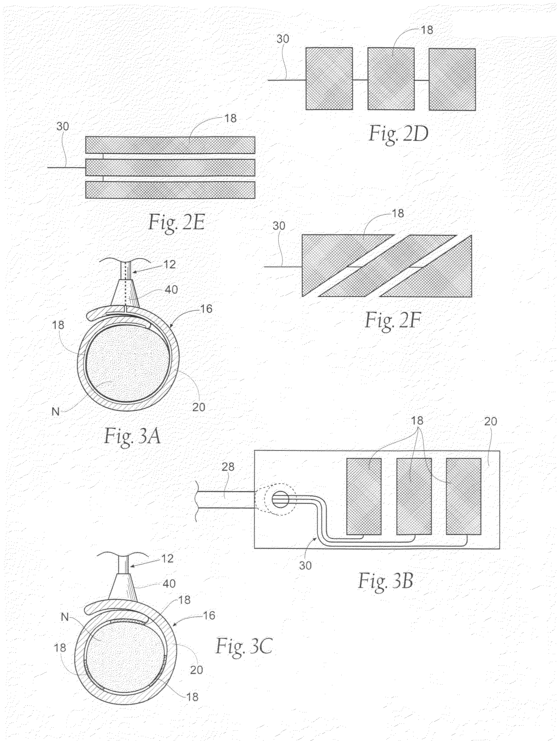 Devices, Systems, and methods employing a molded nerve cuff electrode