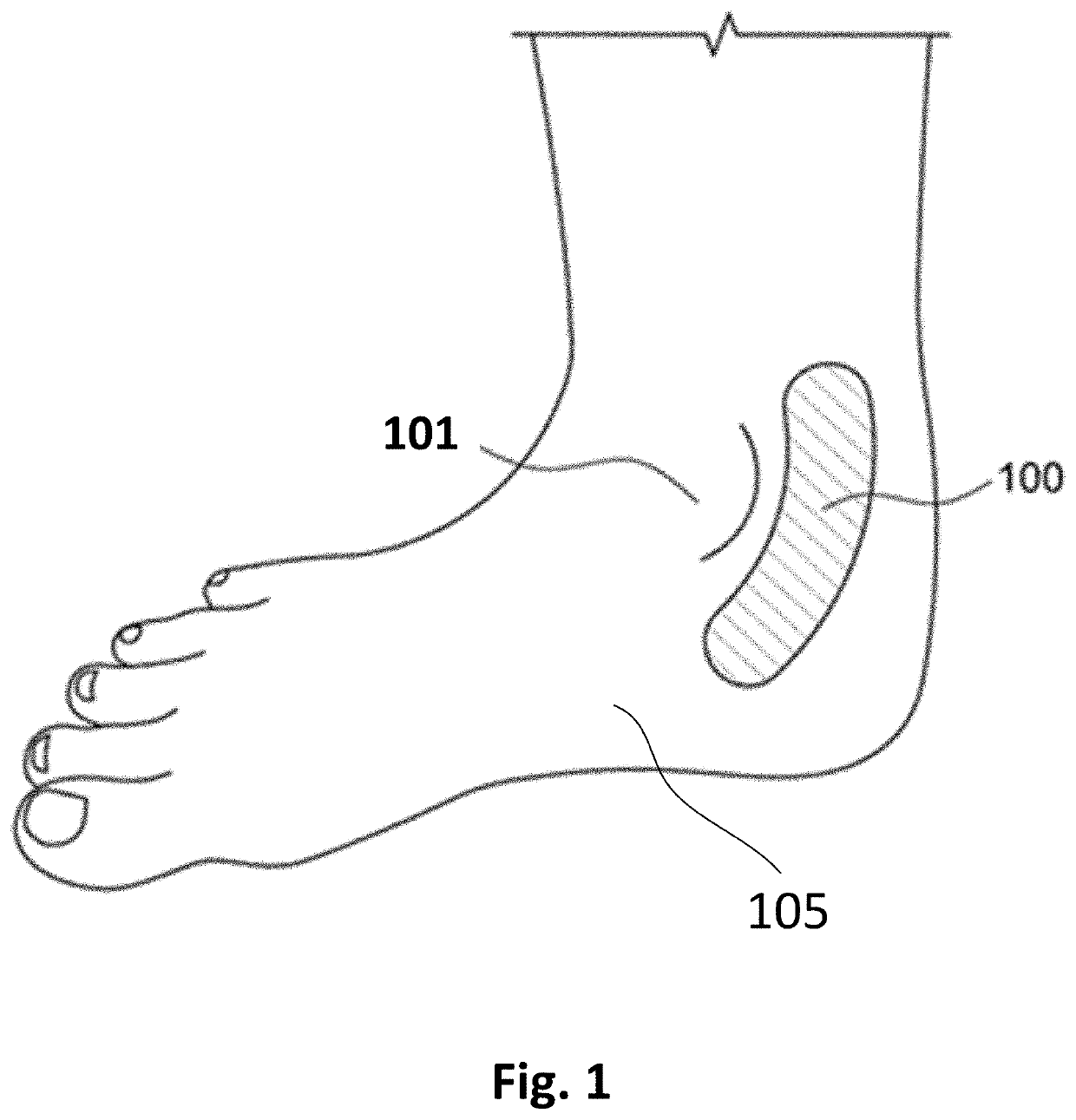 Constipation and Fecal Incontinence Treatment System