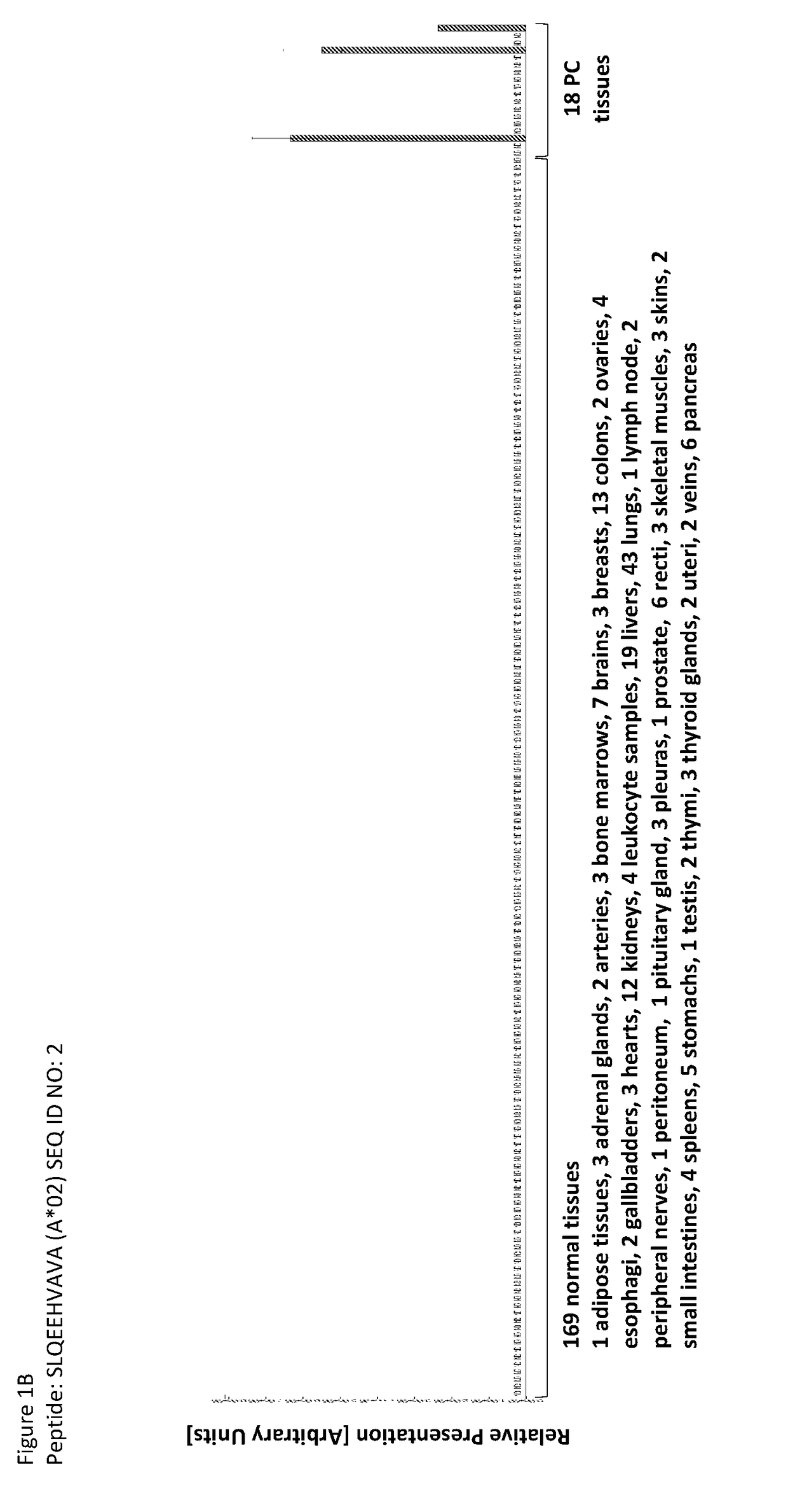 Novel peptides and combination of peptides for use in immunotherapy against pancreatic cancer and other cancers