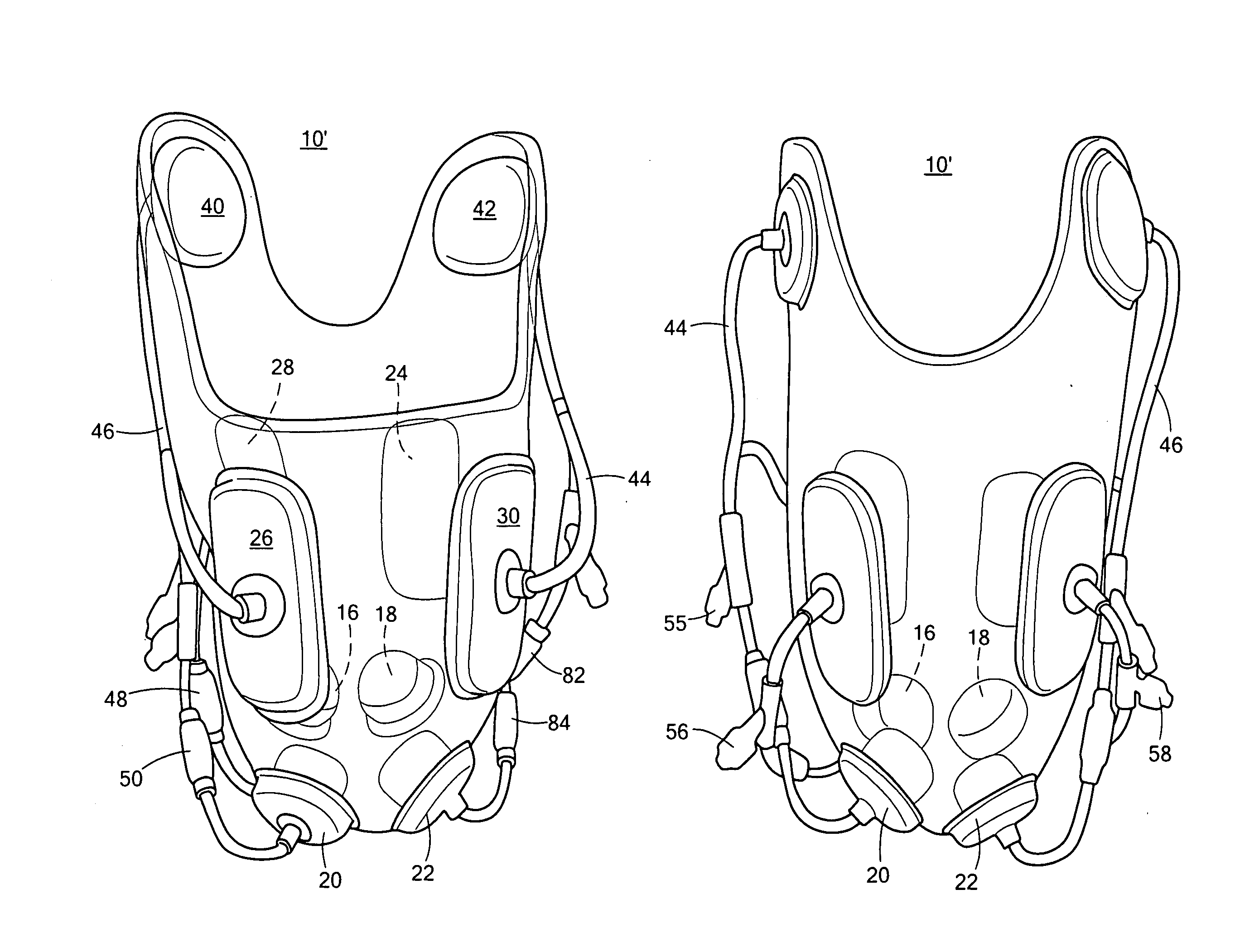 Active prosthetic socket