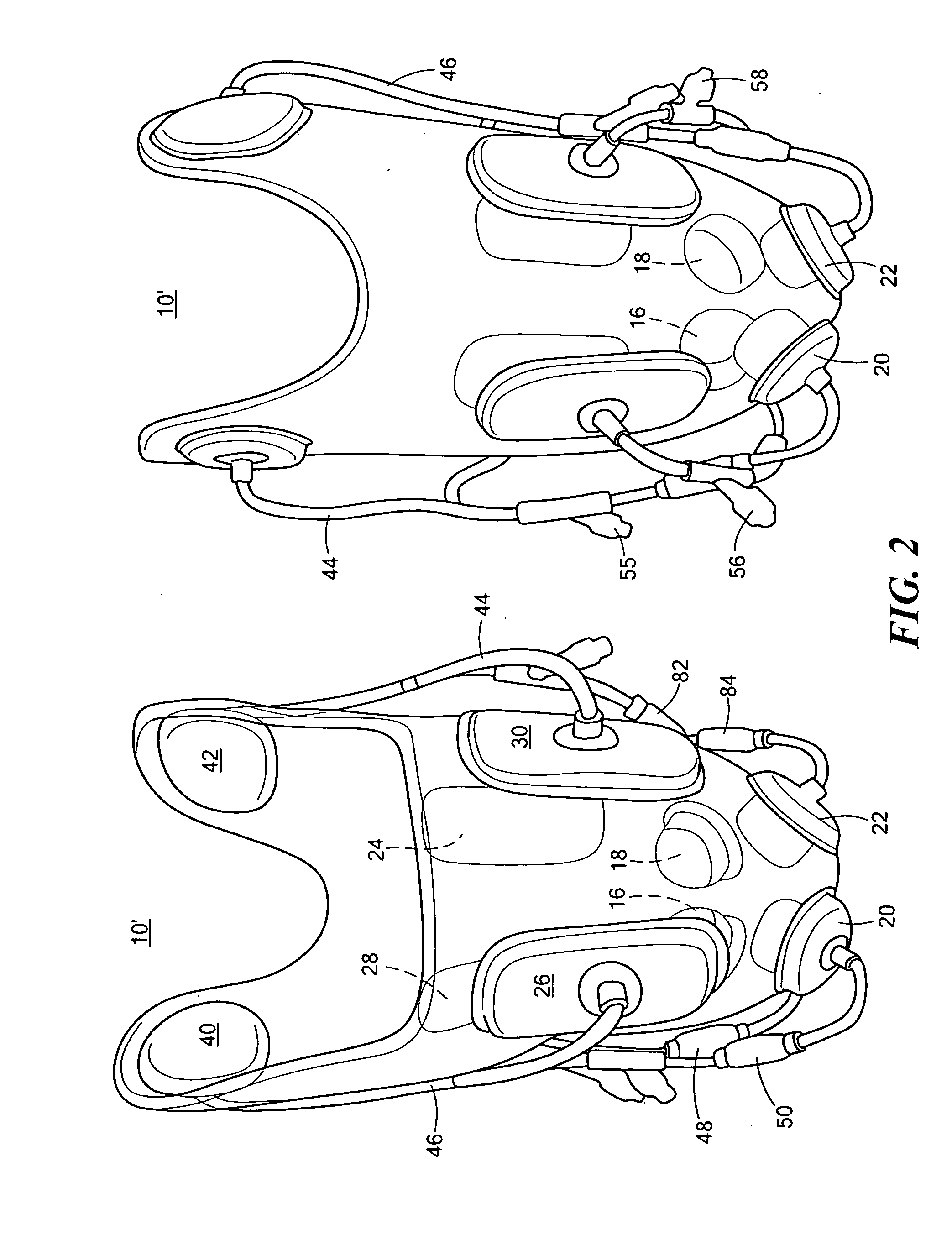 Active prosthetic socket