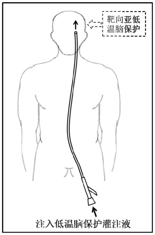 A heat-insulating coating material for medical catheters and its preparation method and application