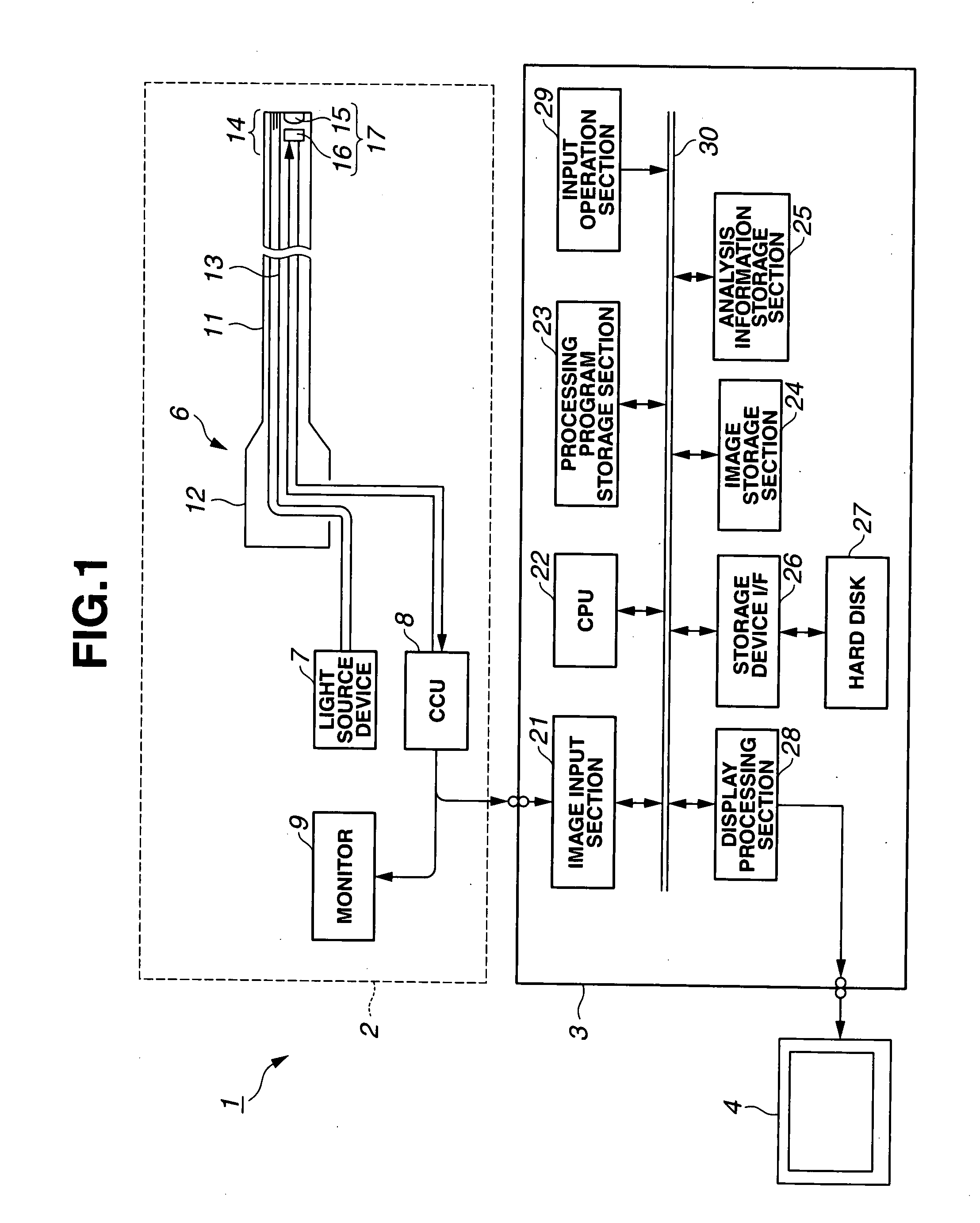 Medical Image Processing Apparatus, Luminal Image Processing Apparatus, Luminal Image Processing Method, and Programs for the Same