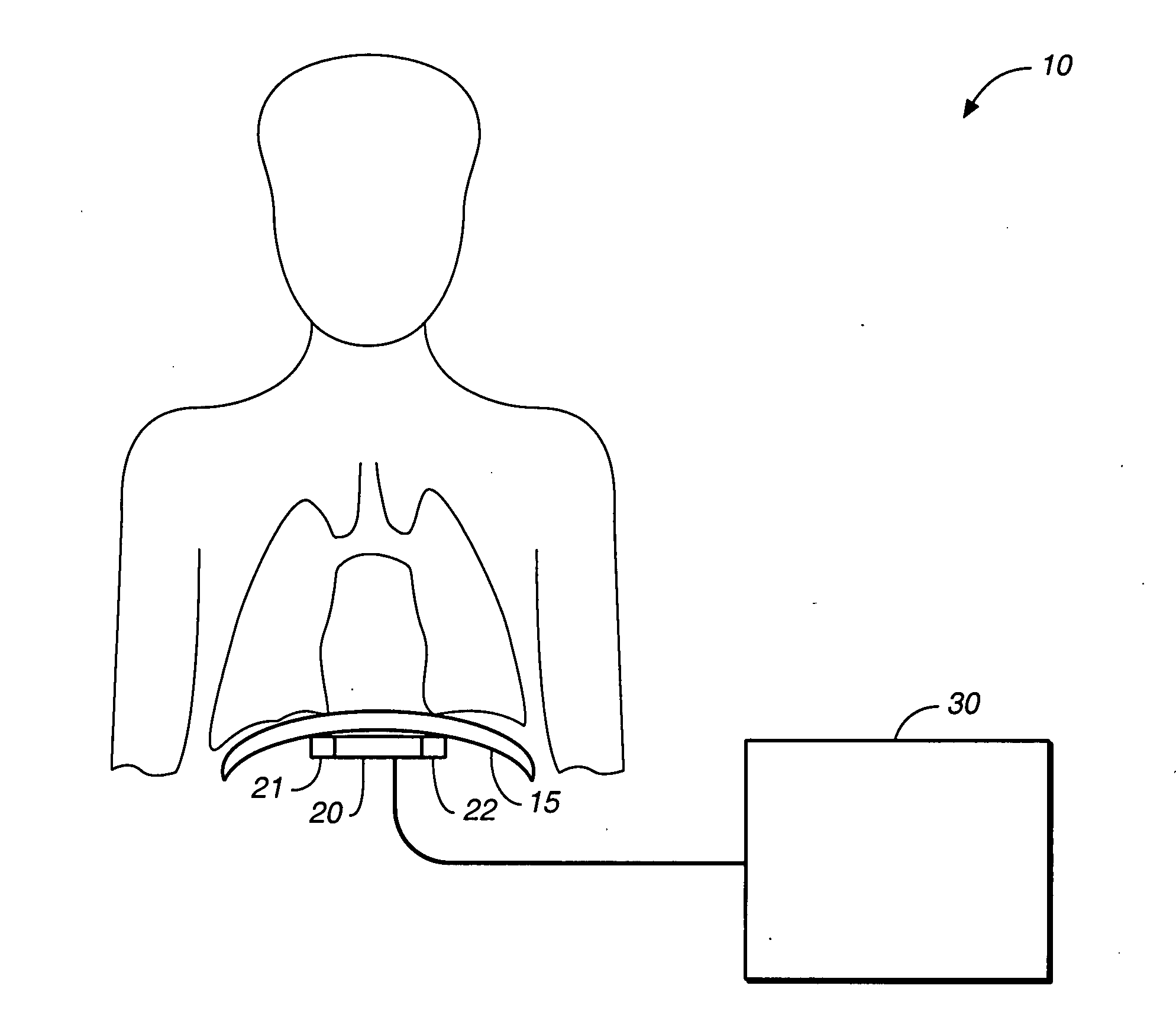 Heart failure patient treatment and management device