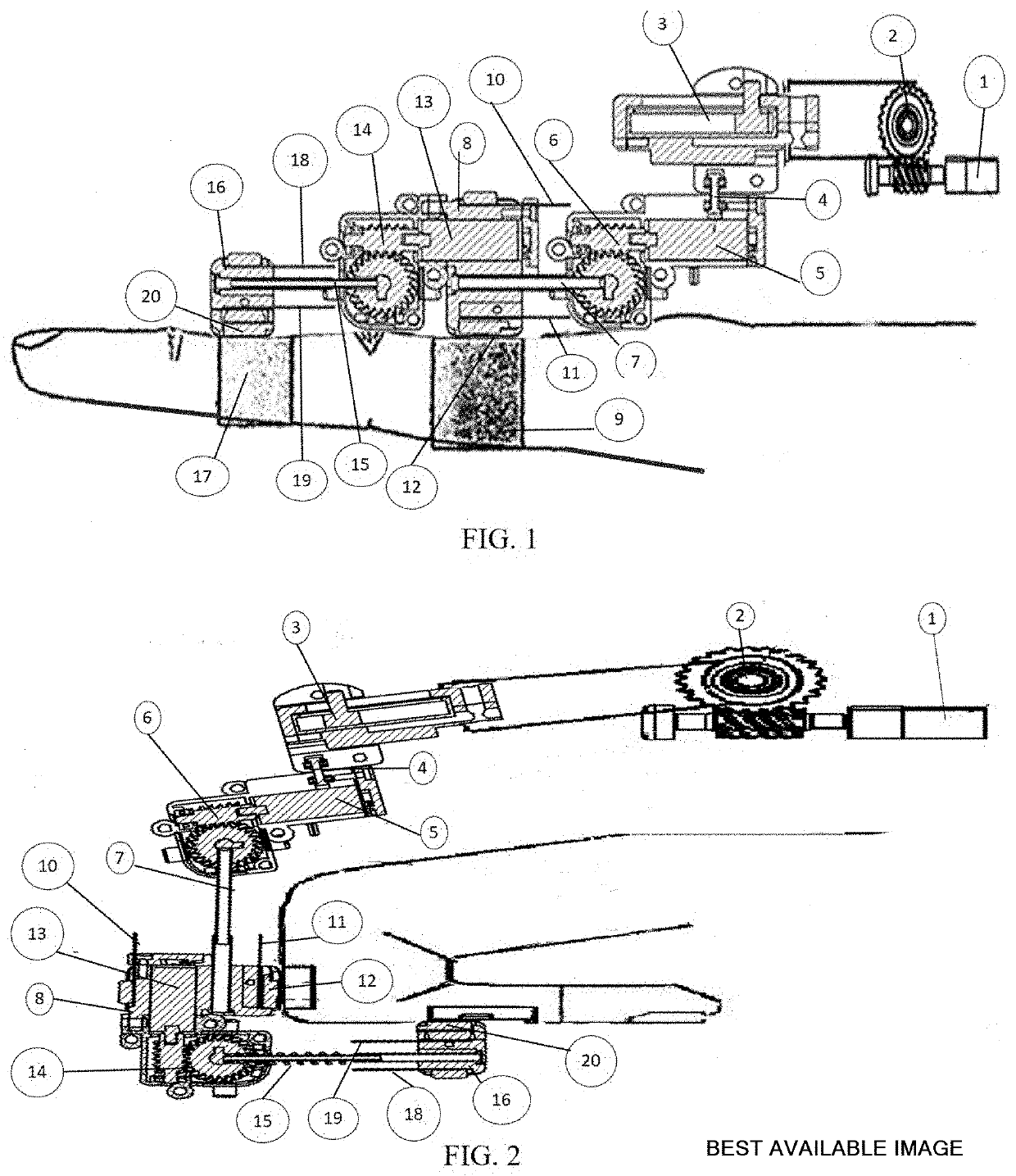 Exoskeleton robot for motor rehabilitation of the hand and wrist