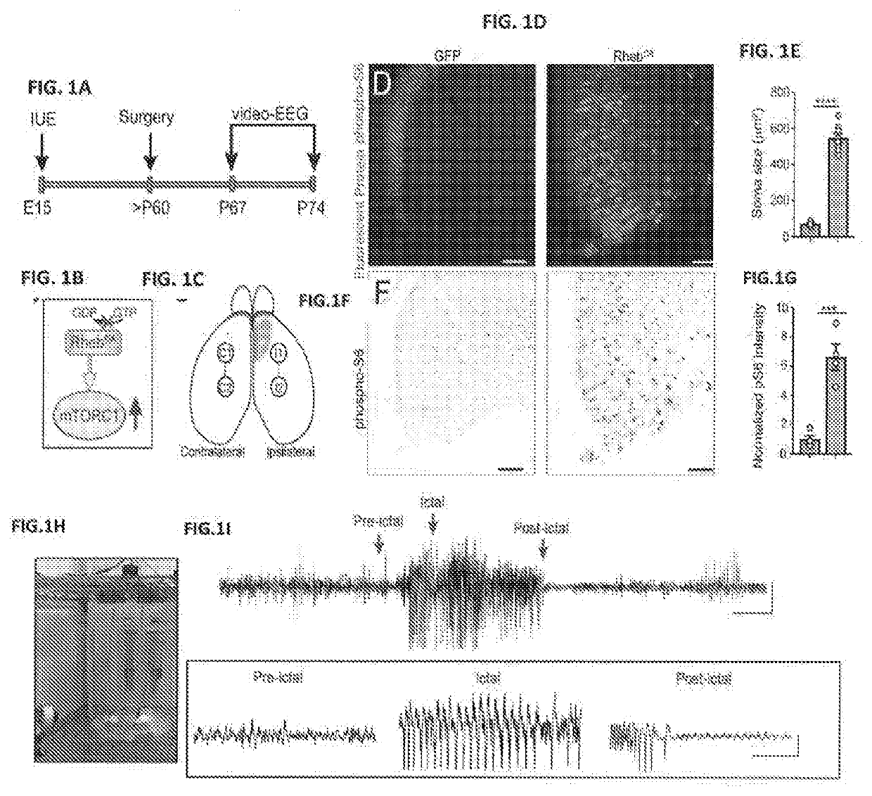 Methods of treating and diagnosing epilepsy