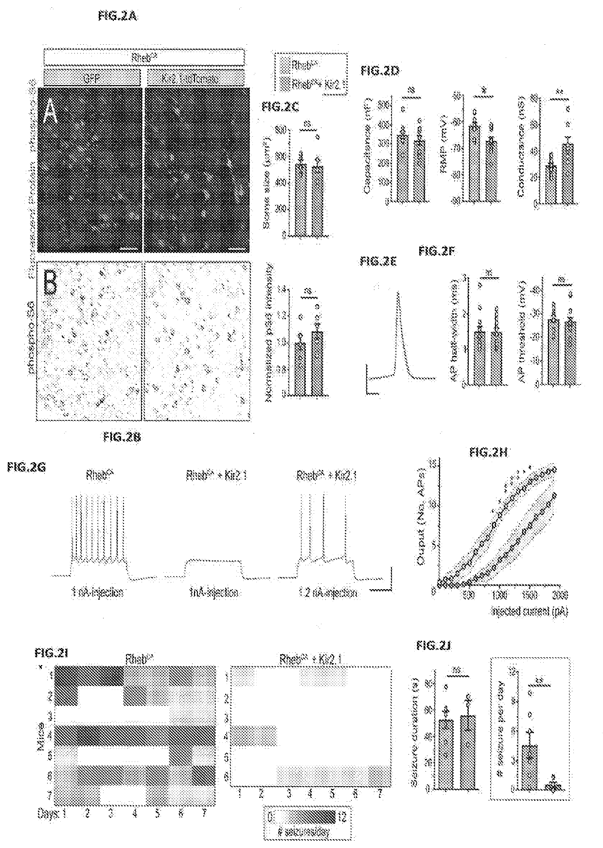 Methods of treating and diagnosing epilepsy