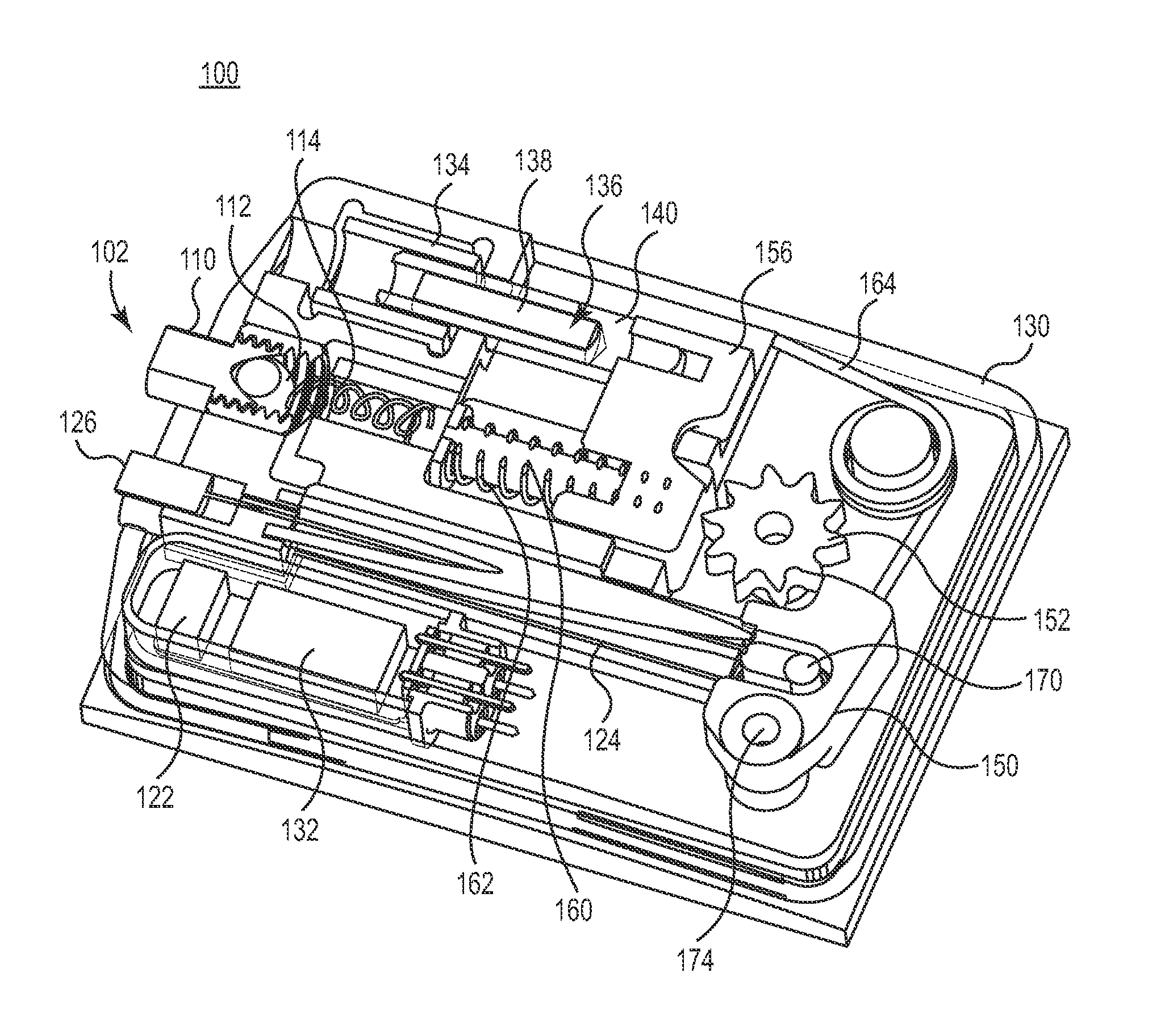 Adjustment for hydrocephalus shunt valve