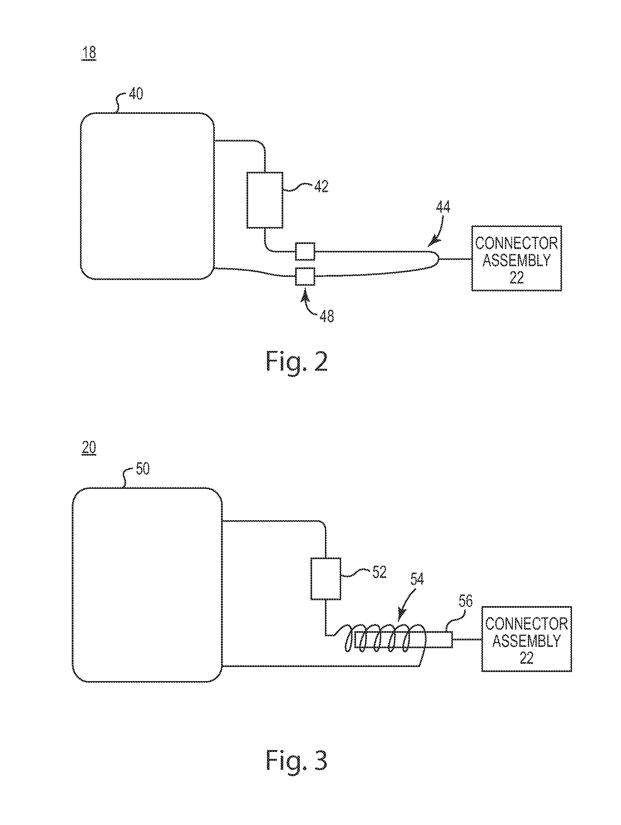 Adjustment for hydrocephalus shunt valve