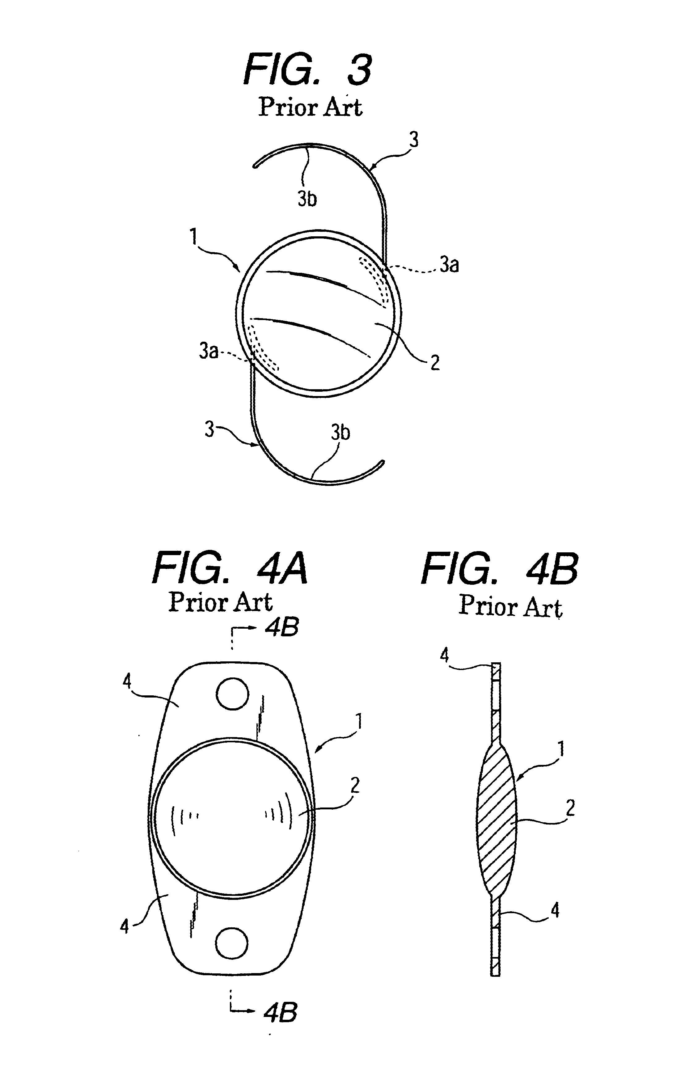 Insertion device for deformable intraocular lens