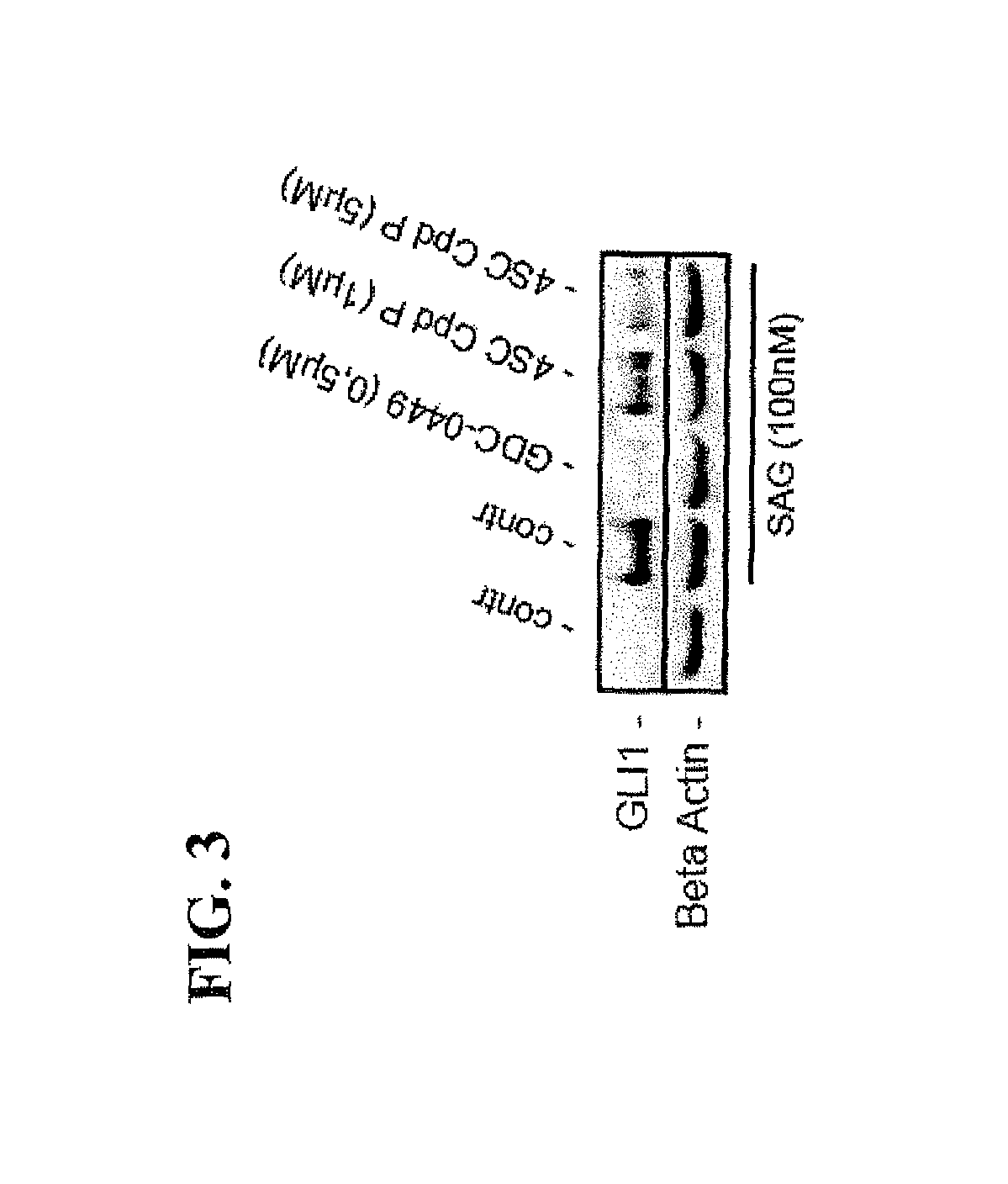 Method of inhibiting DYRK1B