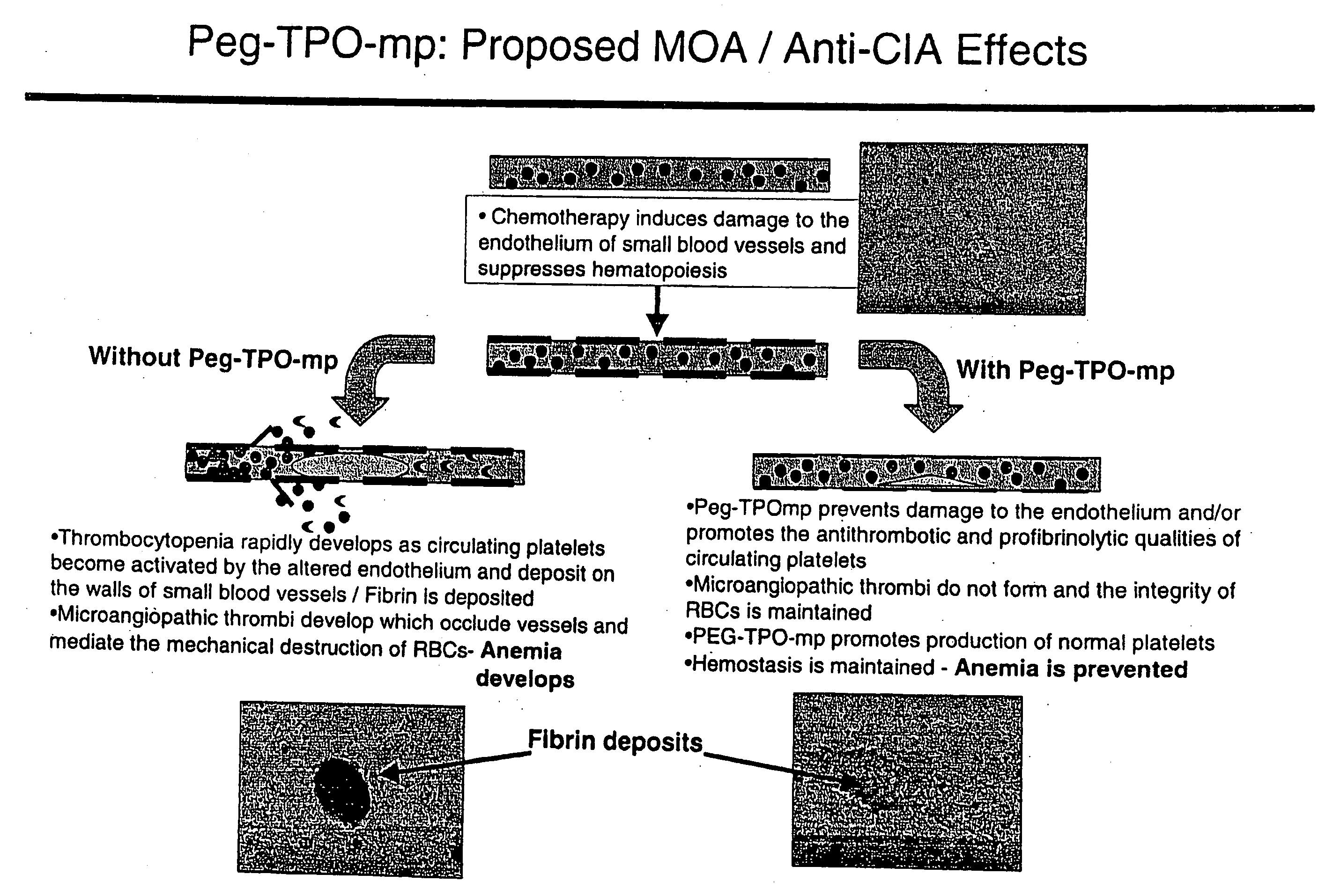 Use of TPO peptide compounds and pharmaceutical compostions in the treatment of anemia