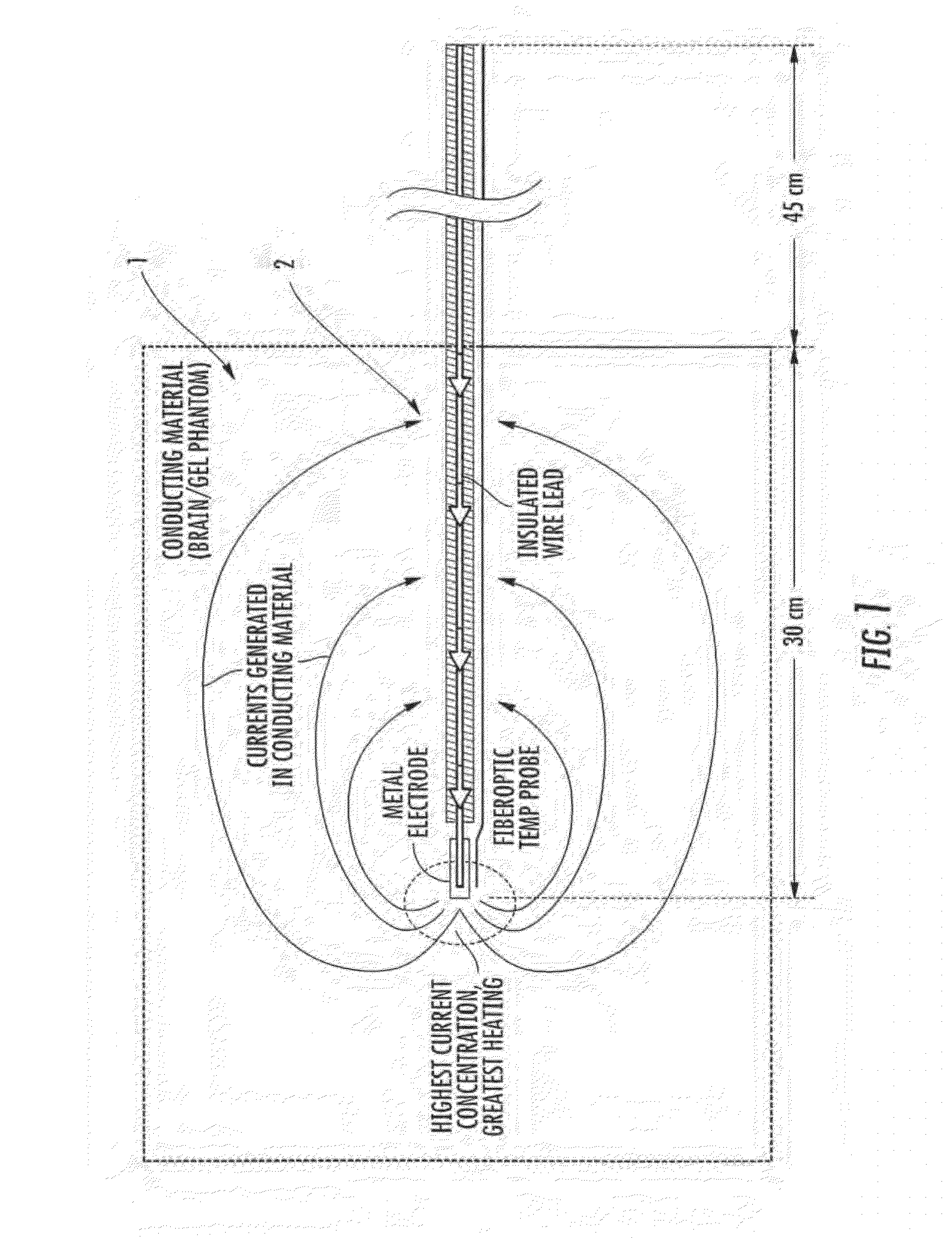 Methods and apparatus for fabricating leads with conductors and related flexible lead configurations