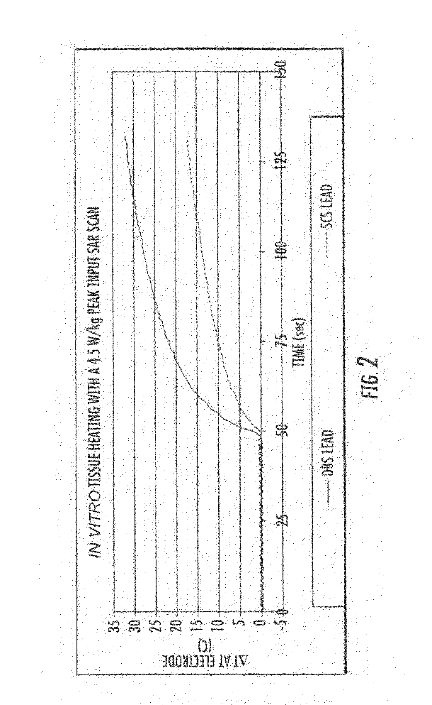 Methods and apparatus for fabricating leads with conductors and related flexible lead configurations