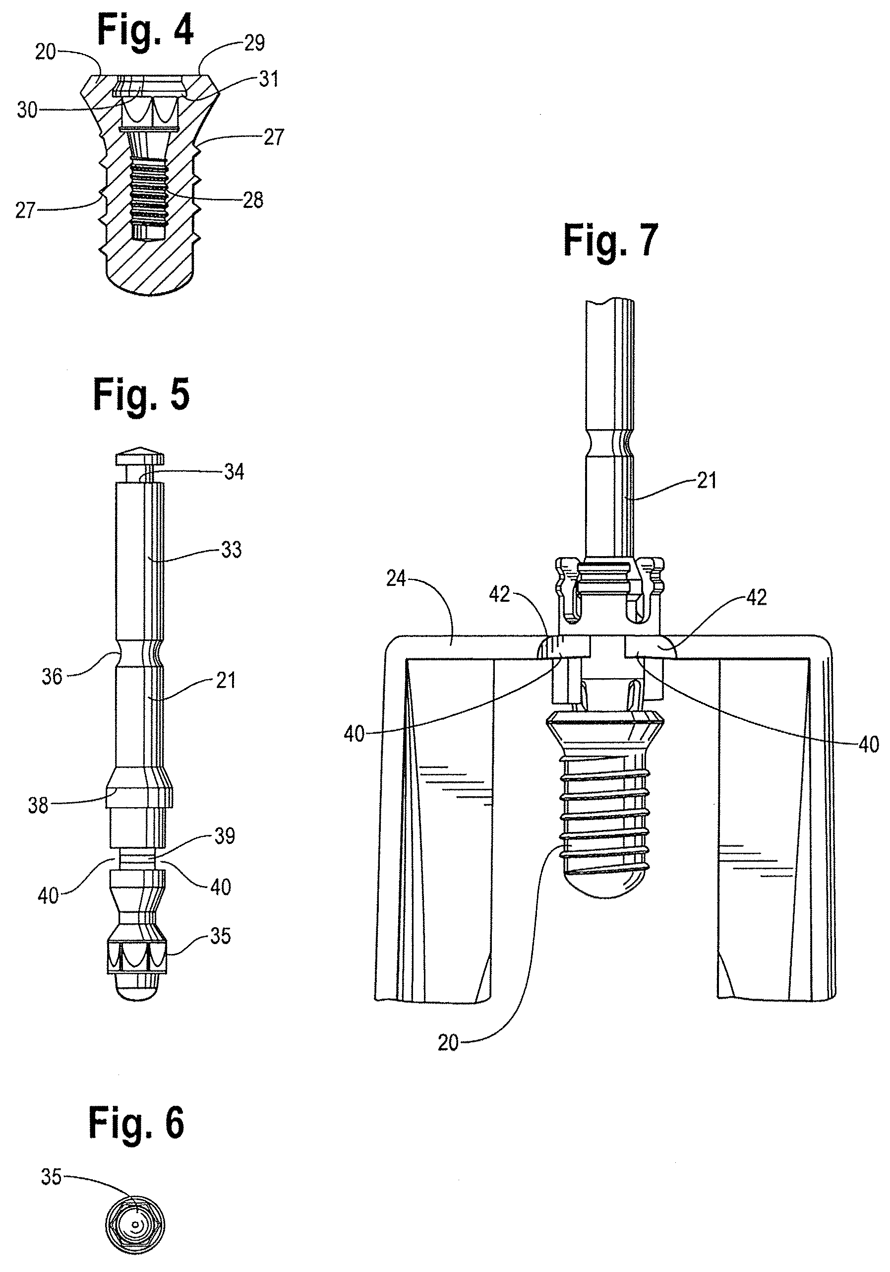 Implant-driver assembly