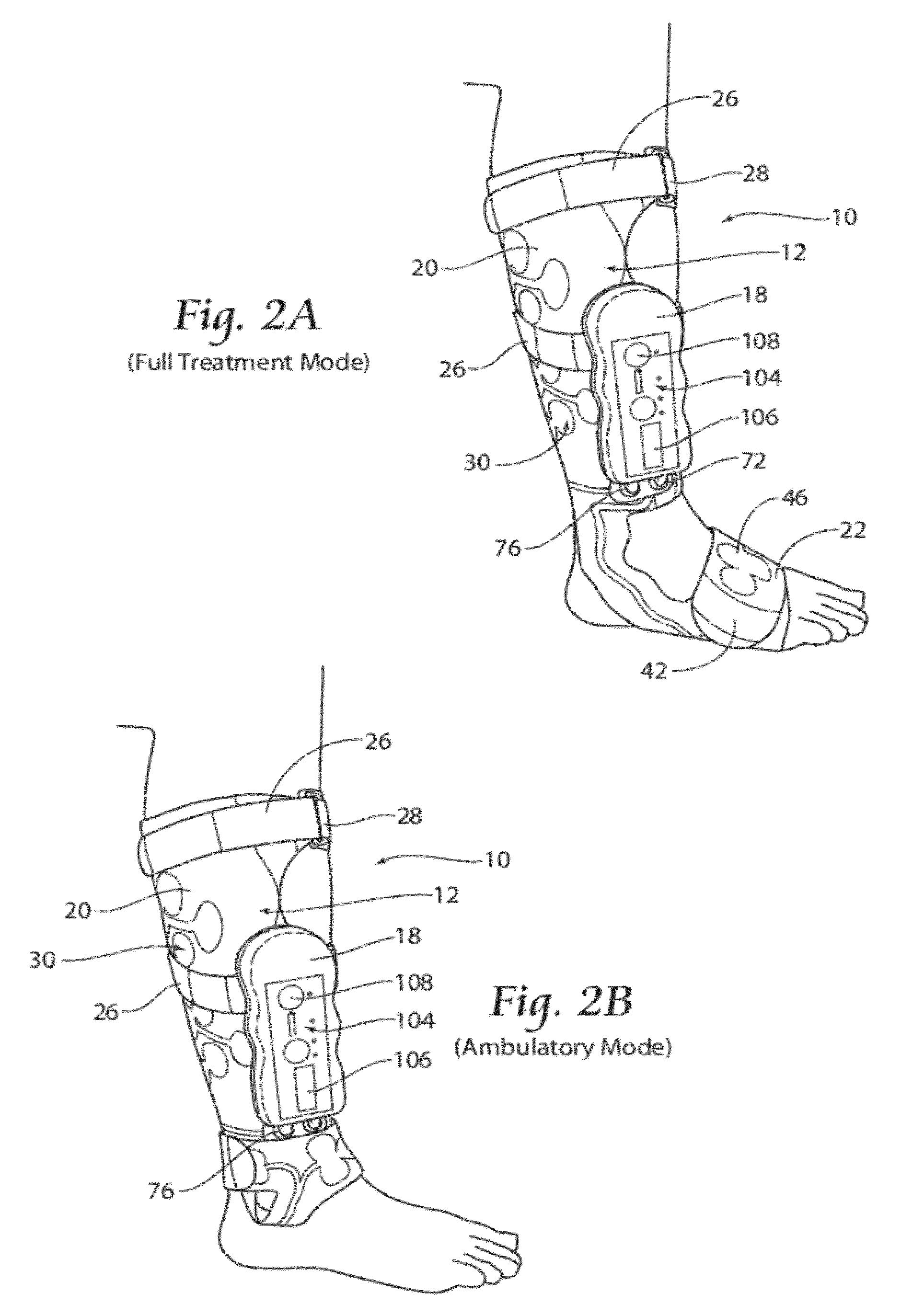 Apparatus, systems, and methods for augmenting the flow of fluid within body vessels