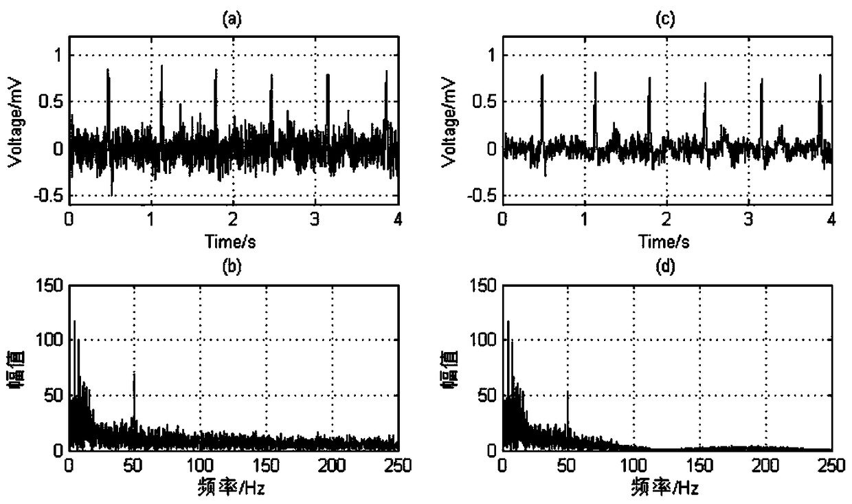 Digital electrocardiogram acquisition method, device and system