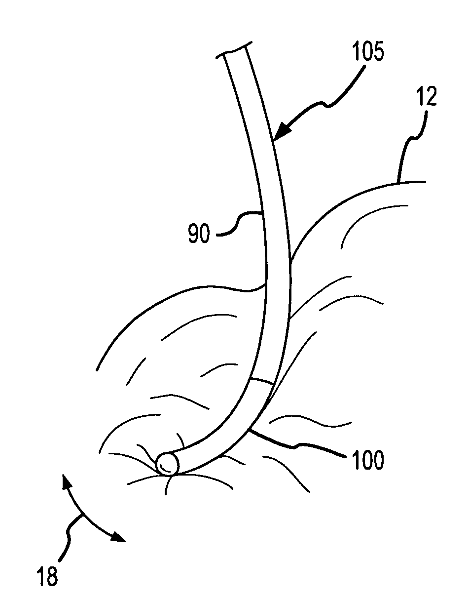 Design of ablation electrode with tactile sensor