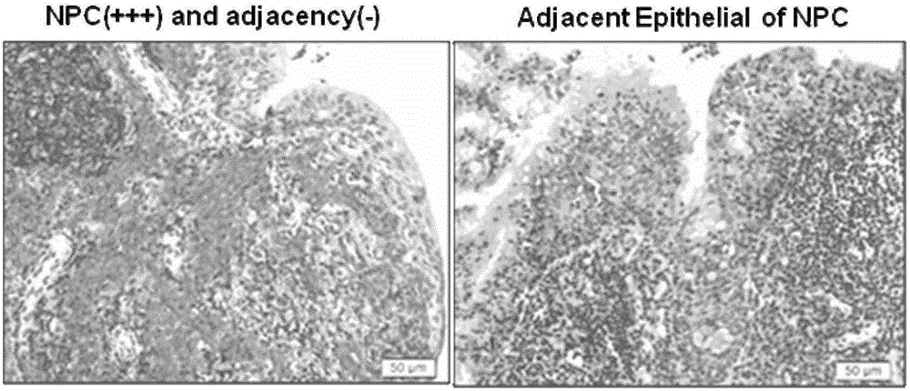 Application of EB virus encoded microRNA BART6-3p to preparation of nasopharyngeal cancer prognostic preparation