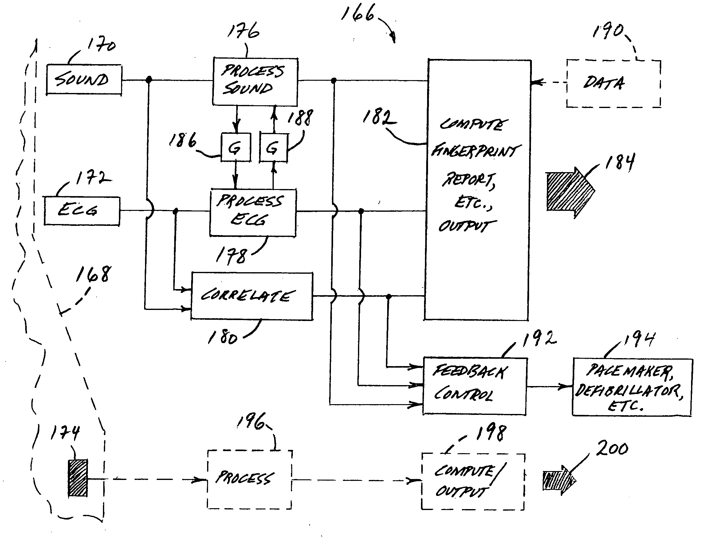 Method and system relating to monitoring and characterizing heart condition